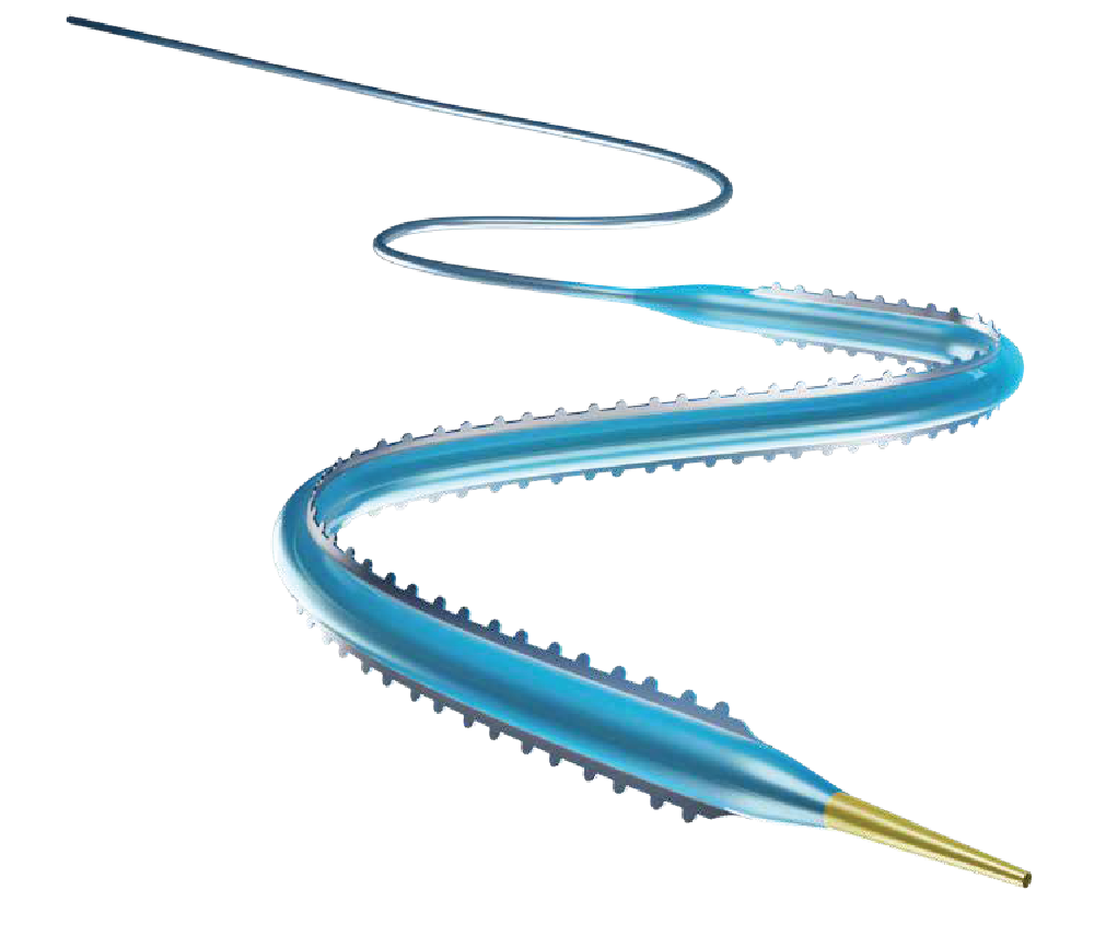 Serranator SL-PRO serration balloon catheter for pedal artery and CLTI treatment