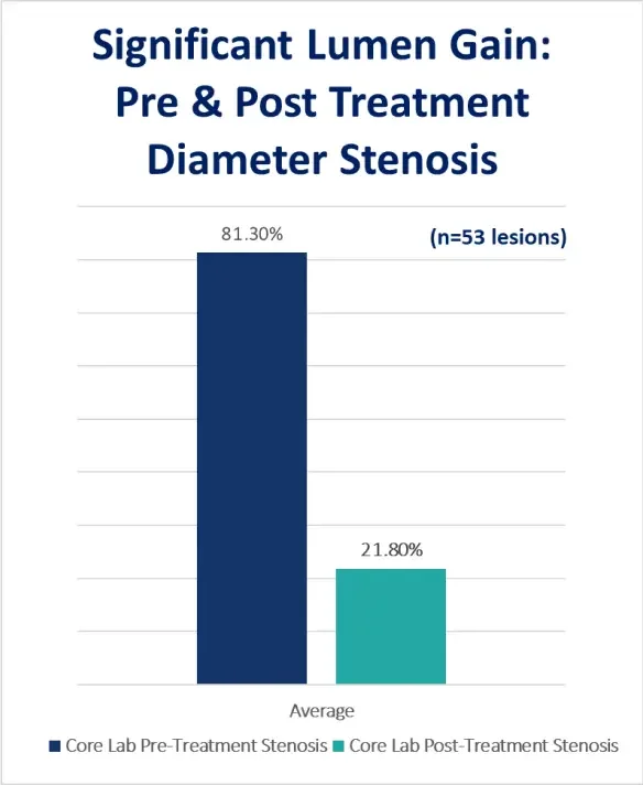 Bar chart showing average diameter stenosis reduced from 81.3% pre-treatment to 21.8% post-treatment with Serranator across 53 lesions
