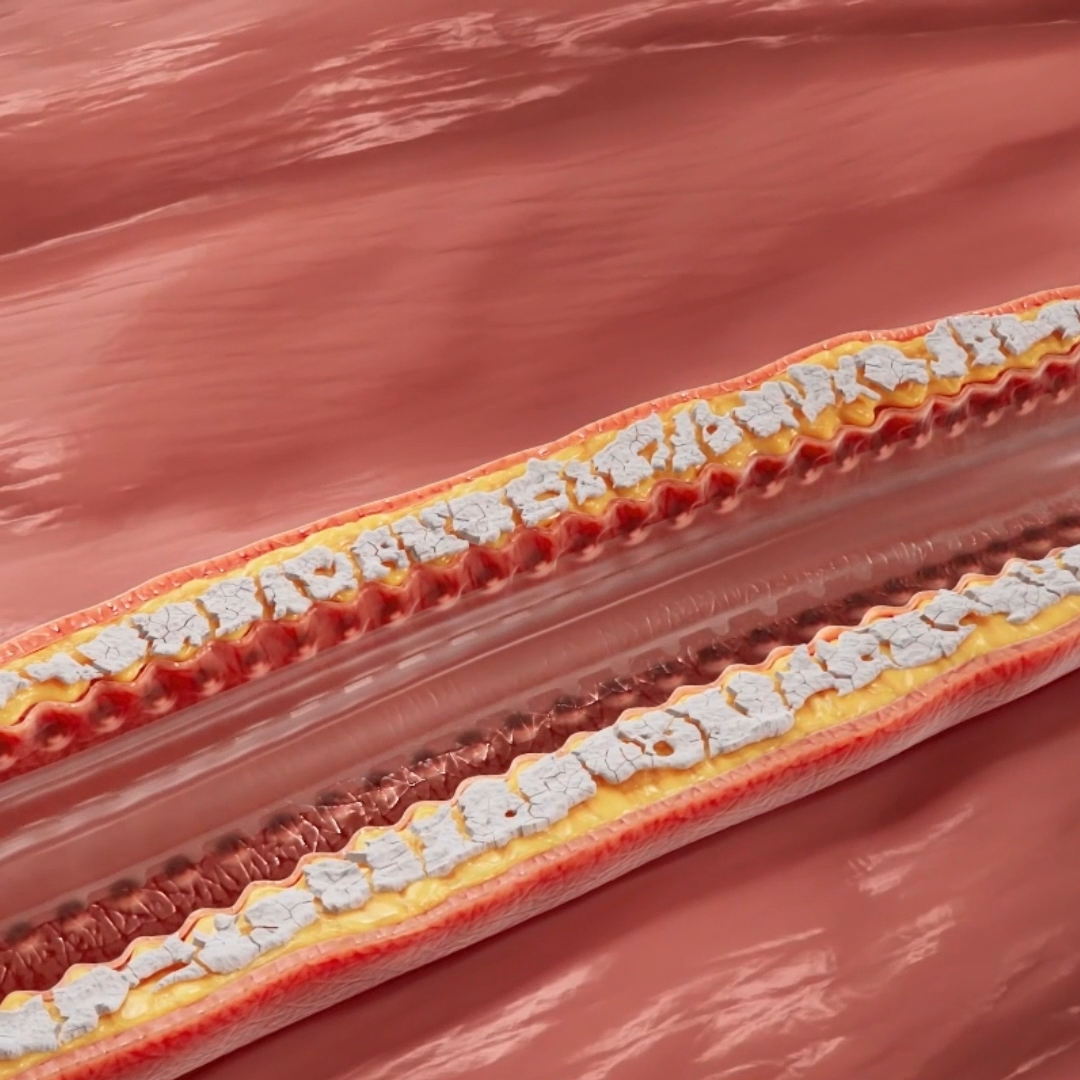 serrantor-technology-cagent-vascular.png