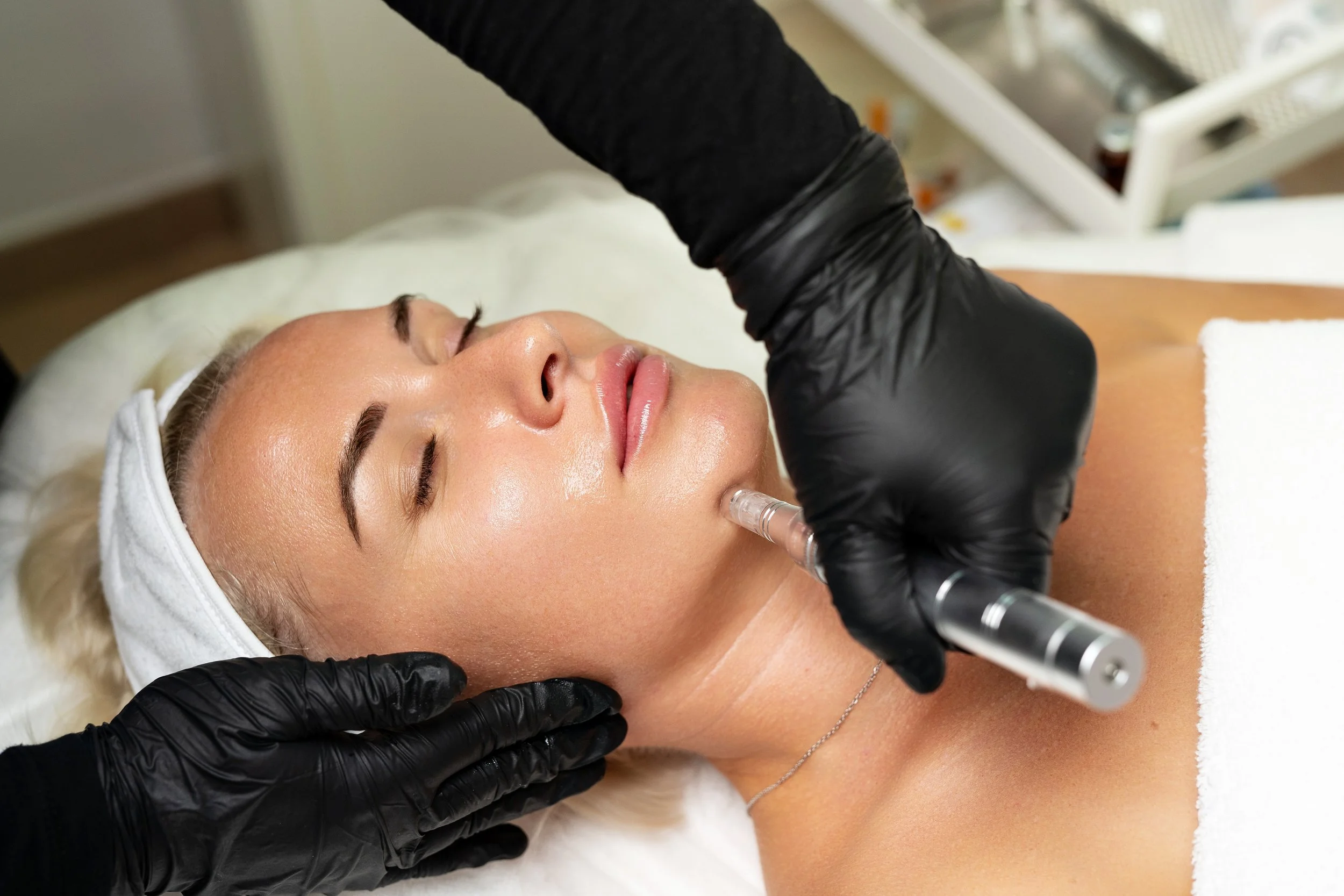 Regenerative Microneedling Therapy