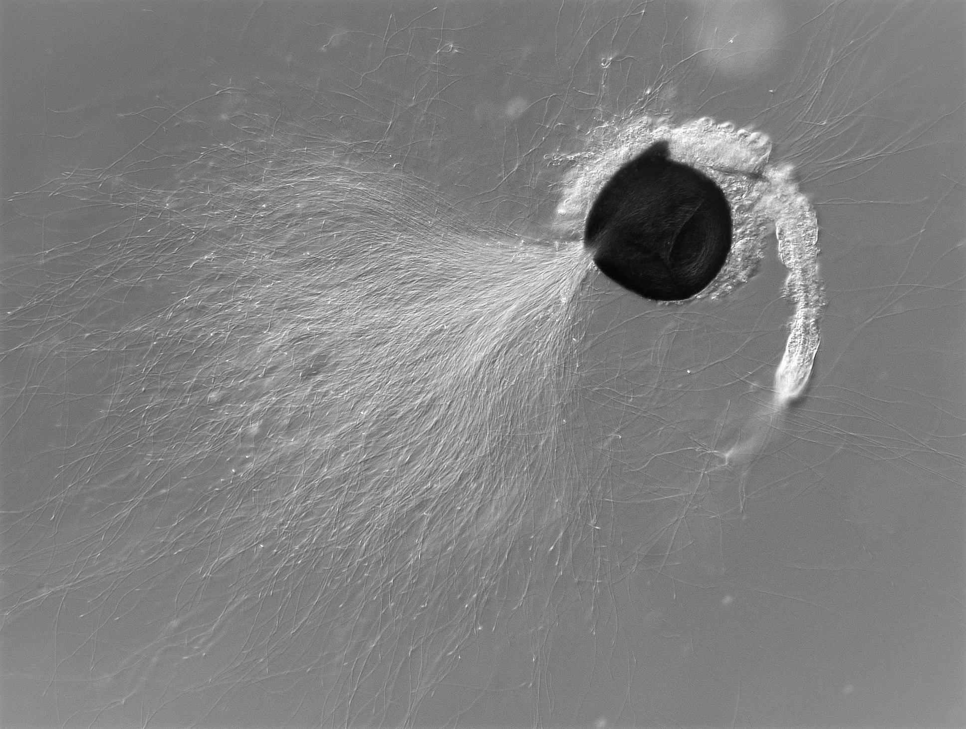 Bursting of the spermathecae releasing male mosquito sperms, seen under light microscope. Credit J. Bagi