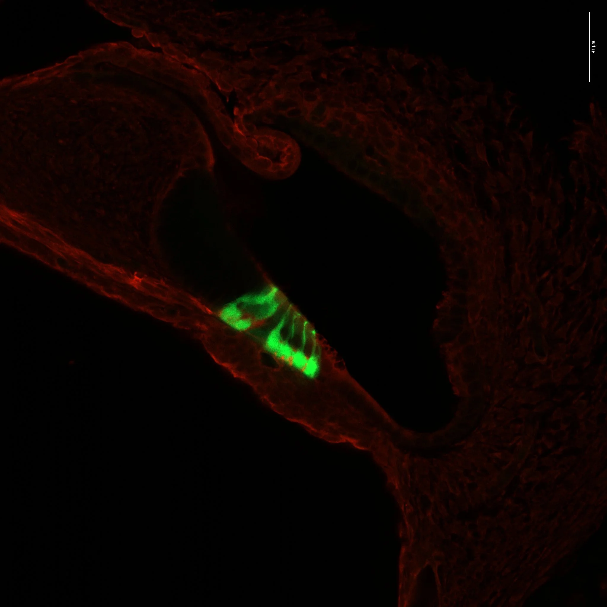 Maturation and sensory hair cell regeneration potential