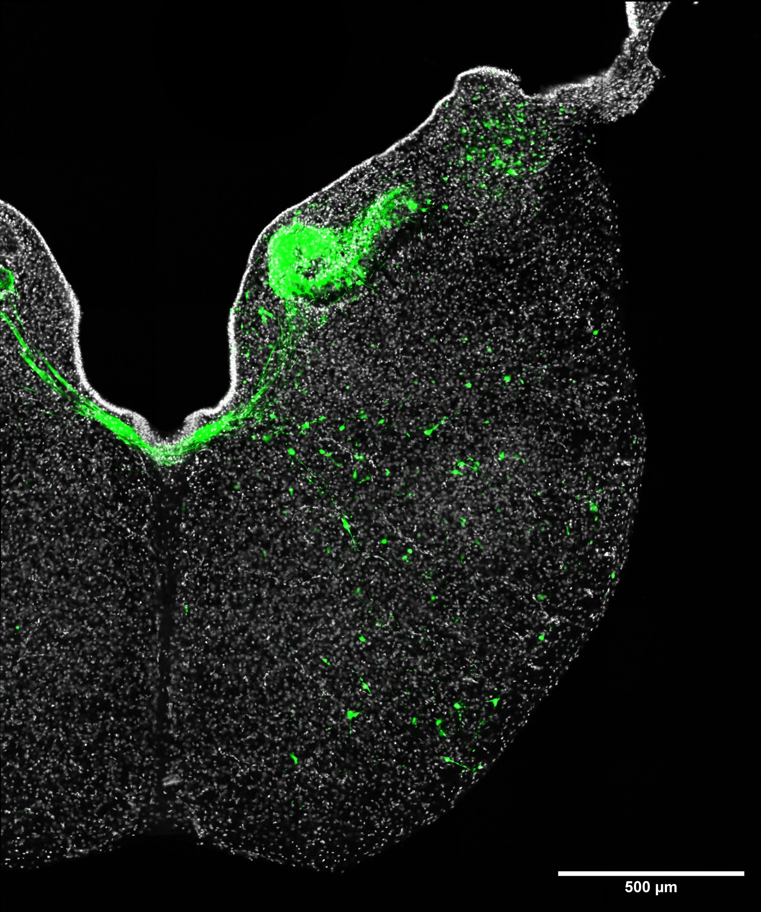 Evolution and development of brainstem sound localisation circuits