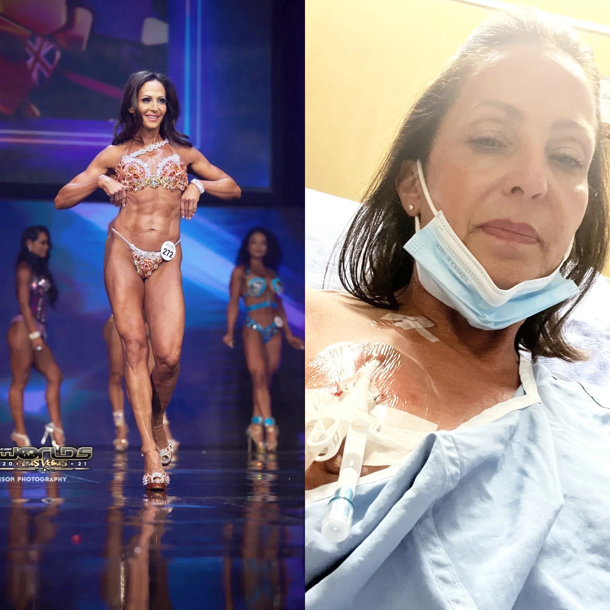 My Cancer Experience