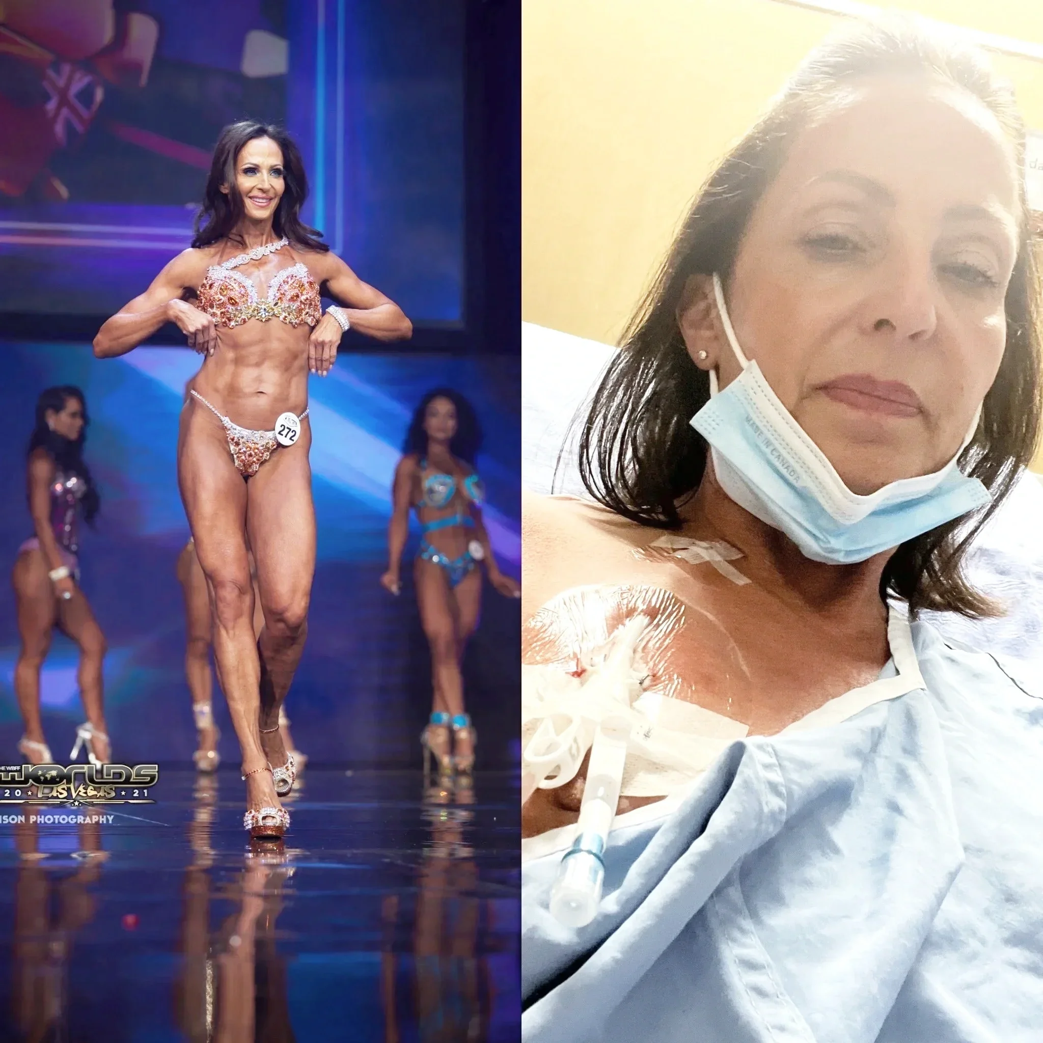 A woman in a sparkly bikini with a contestant number 272 on her waist, standing on a stage during a fitness competition. The right side of the image is a close-up selfie of the same woman receiving cancer treatment.