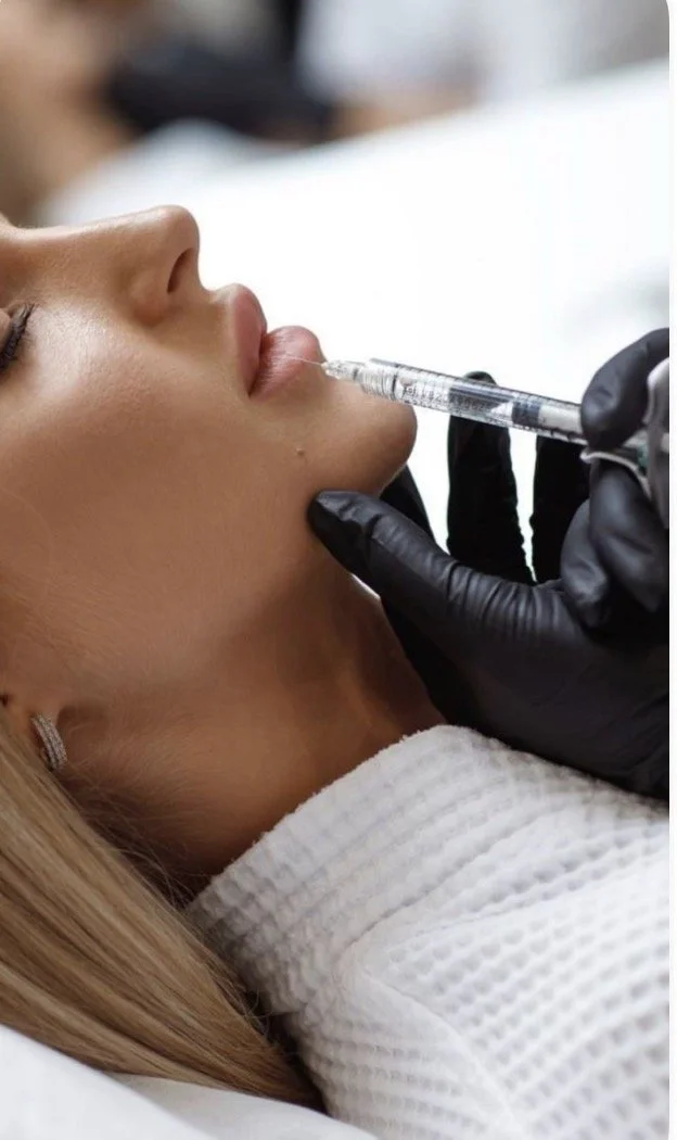 lip filler.jpg