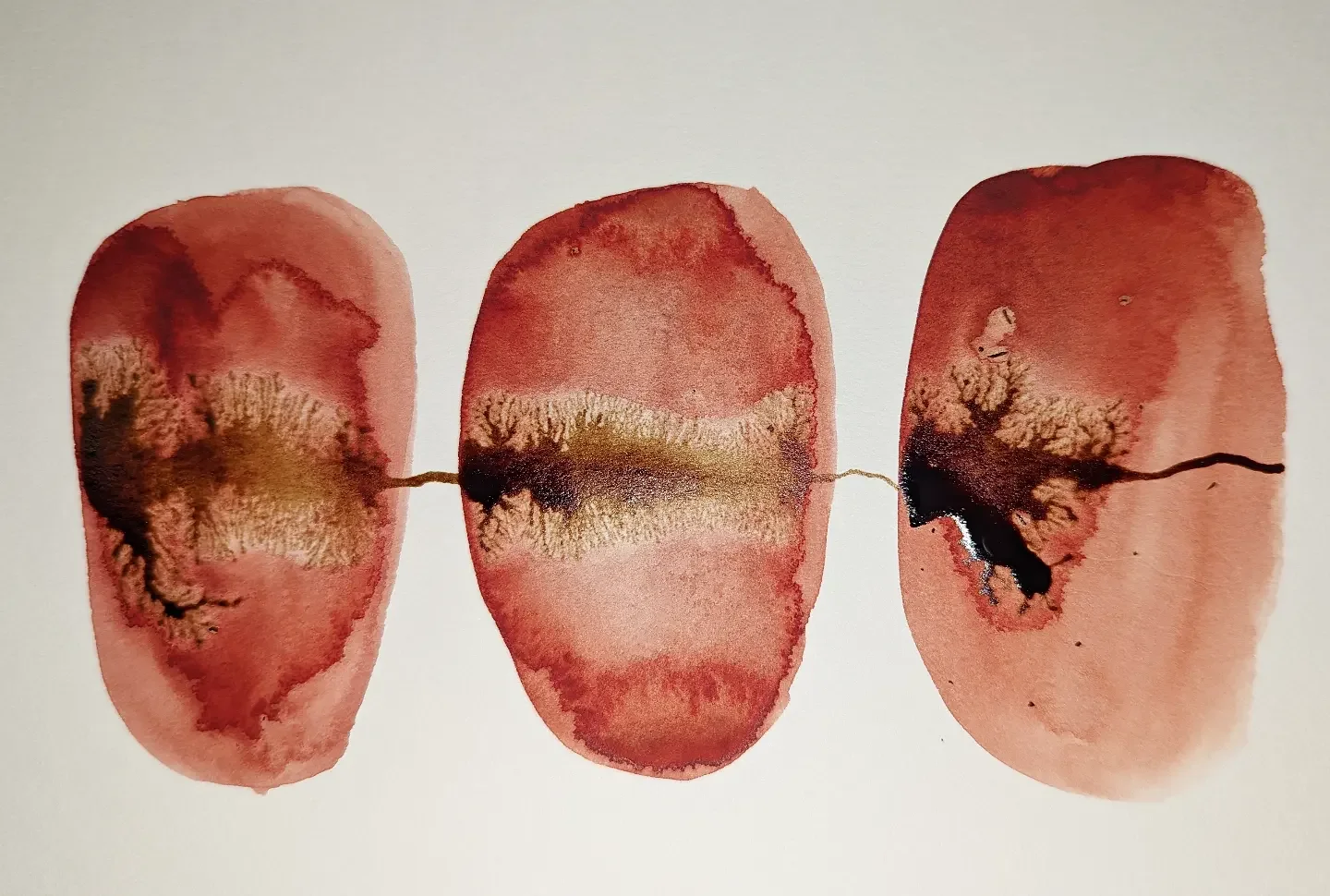 PCOS, irregular & absent cycles