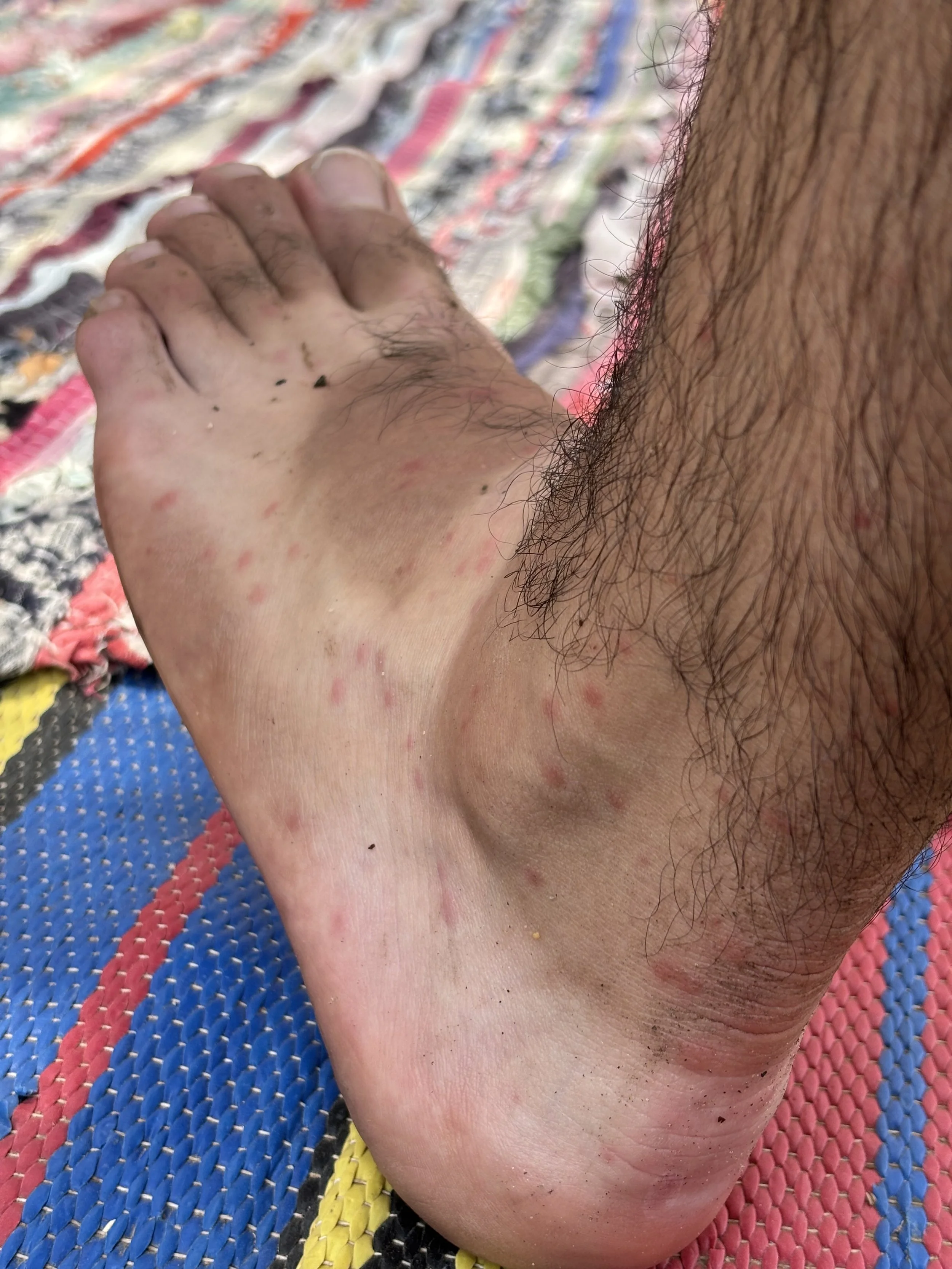 Pie con picadoras en Egipto.