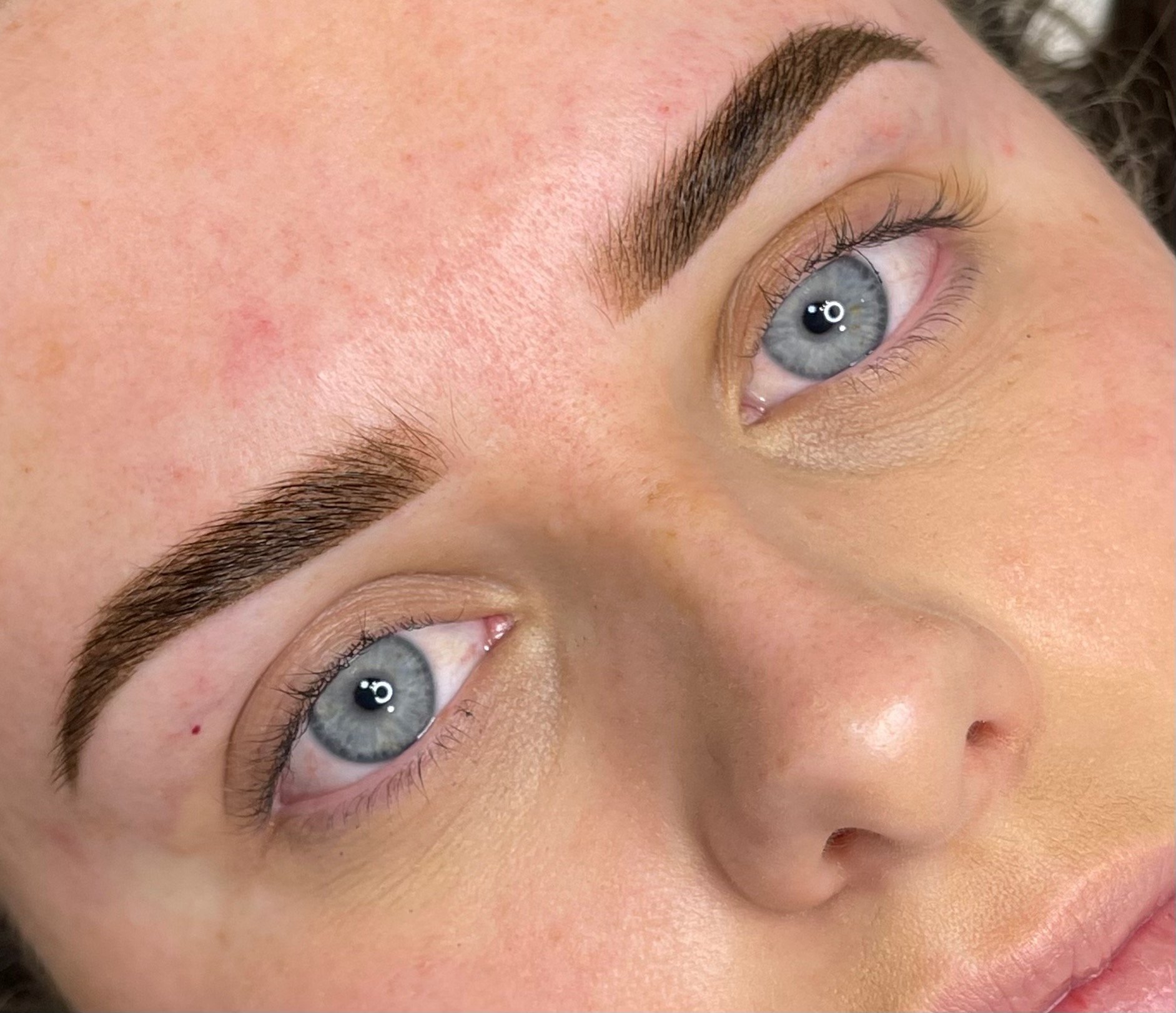 Close-up of a person lying down with visible eyebrows, blue eyes, and skin with some redness.