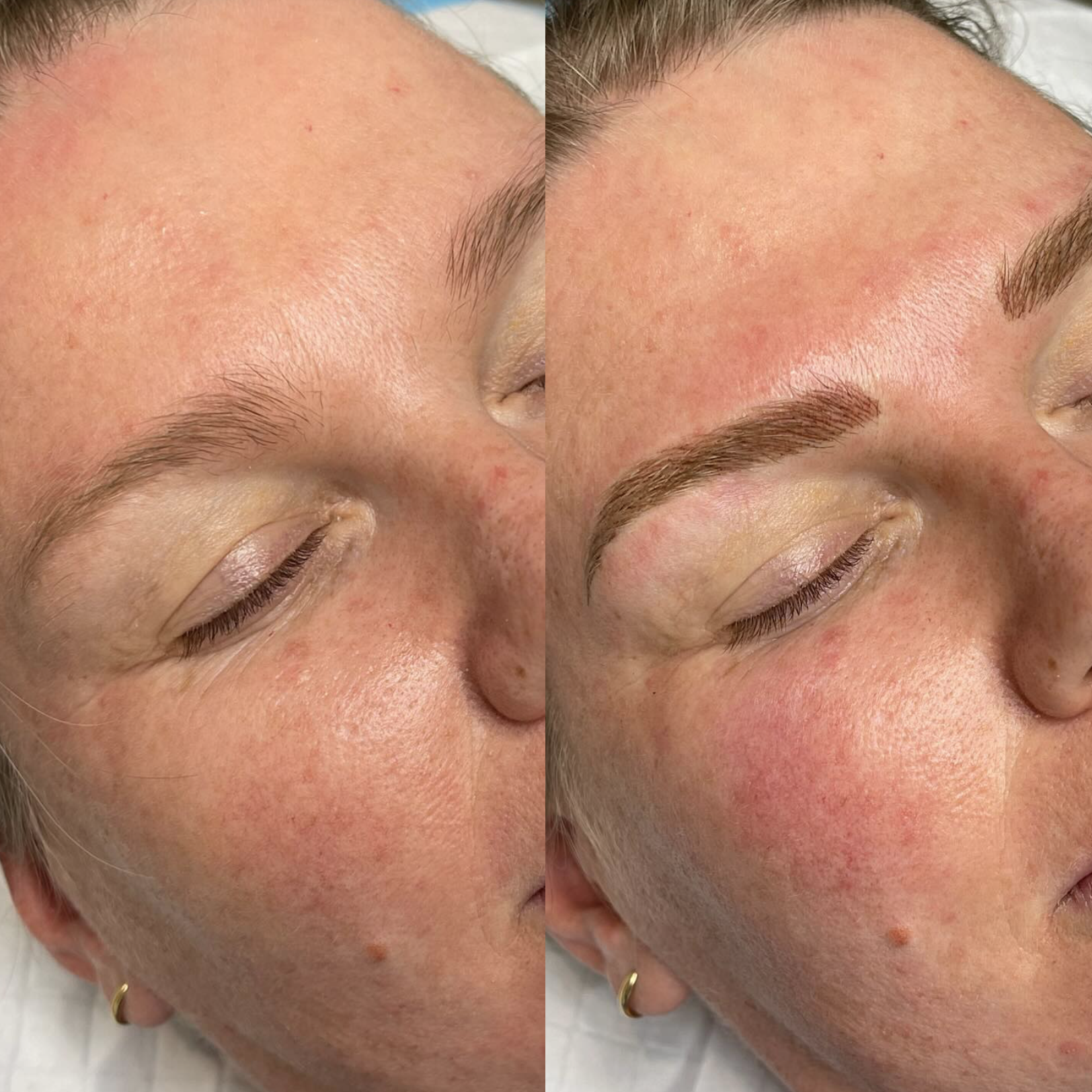 Close-up of a person's face showing a before and after comparison of eyebrow microblading results.
