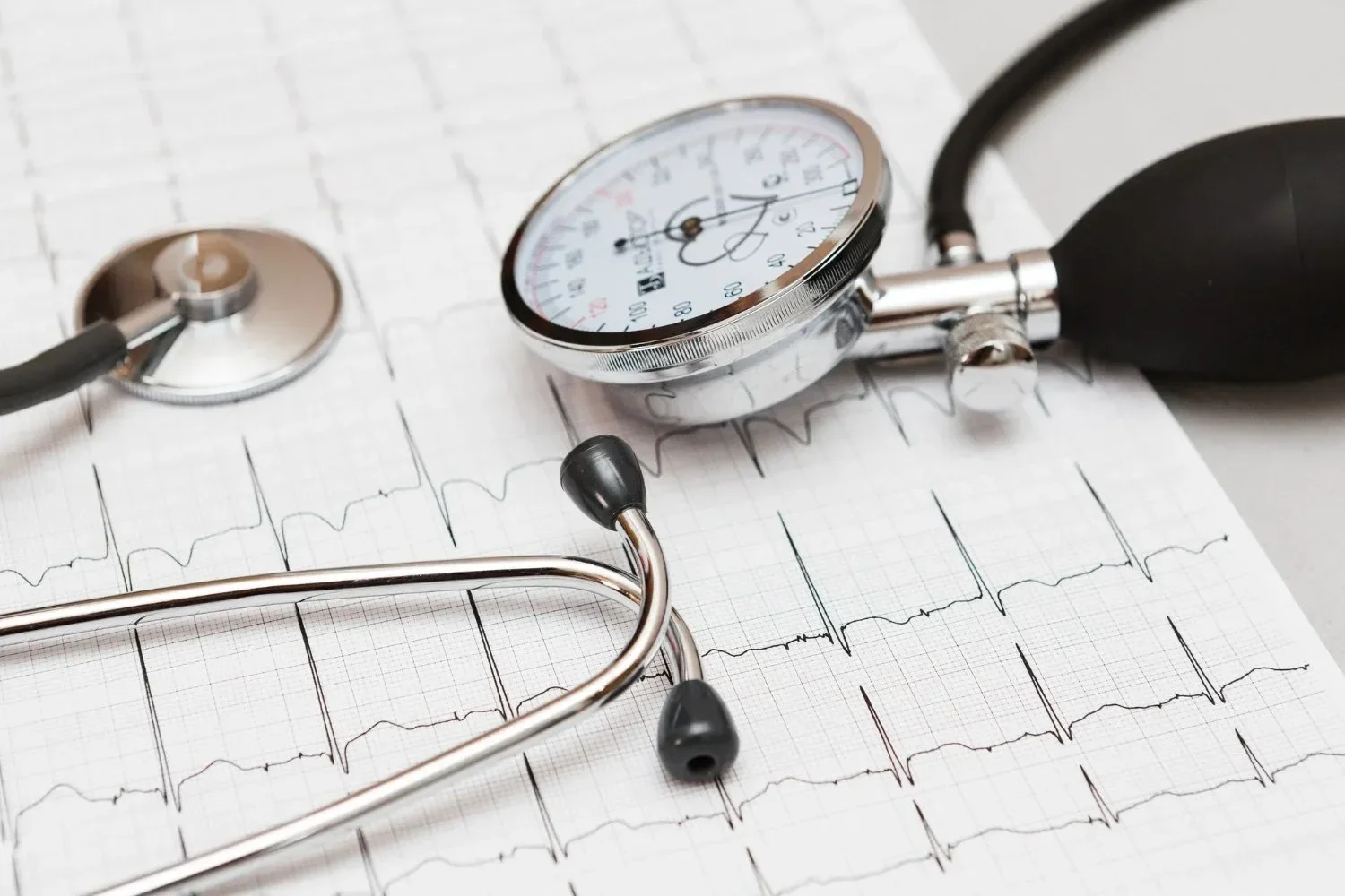 A stethoscope and sphygmomanometer rest on an ECG printout. 