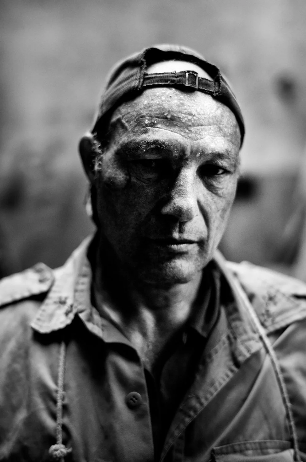 A black and white close-up portrait of a man with a serious expression, wearing a backward baseball cap and a military-style jacket, with a damaged face and injuries.