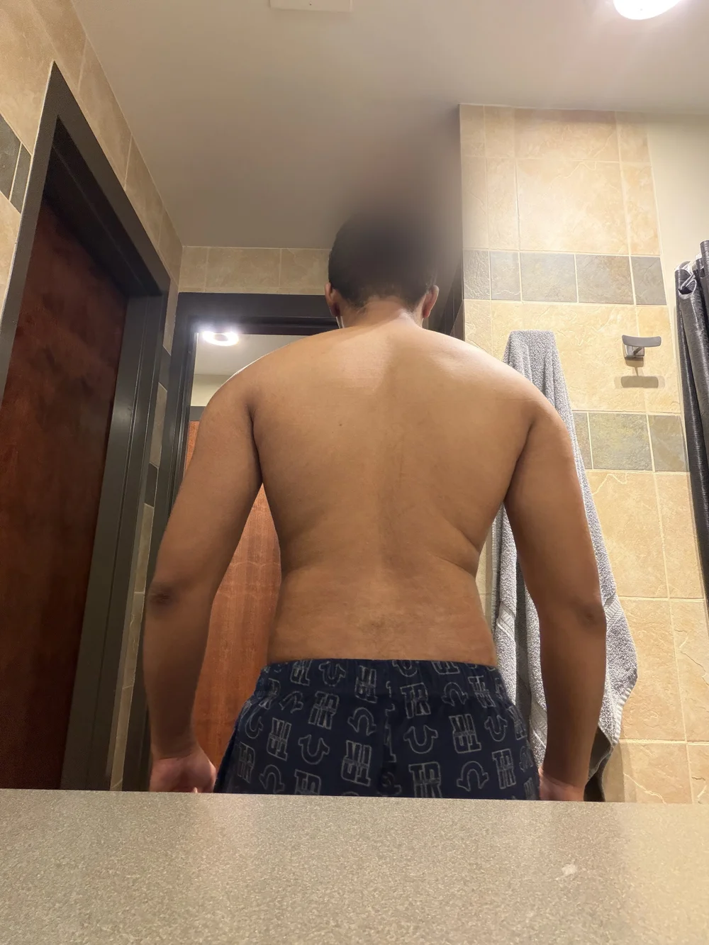 Malachi, back, before
