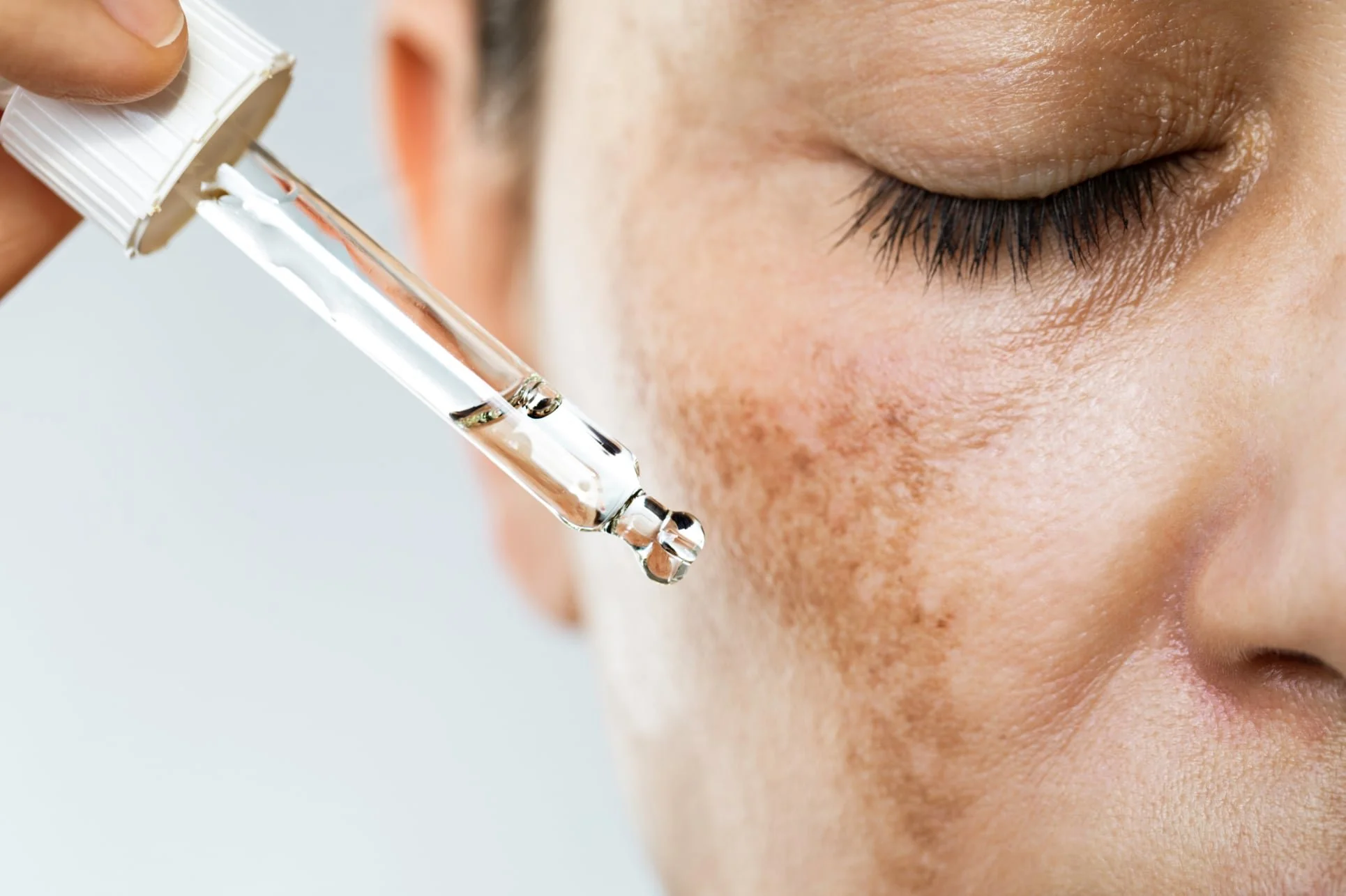 Person applying skincare serum to face with a dropper.