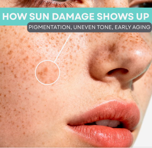 Close-up of a person's face showing sun damage, including pigmentation, uneven skin tone, and early aging signs on the cheek and near the nose.