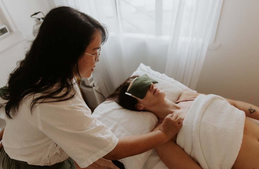 Jimboomba Natural Therapies acupuncture