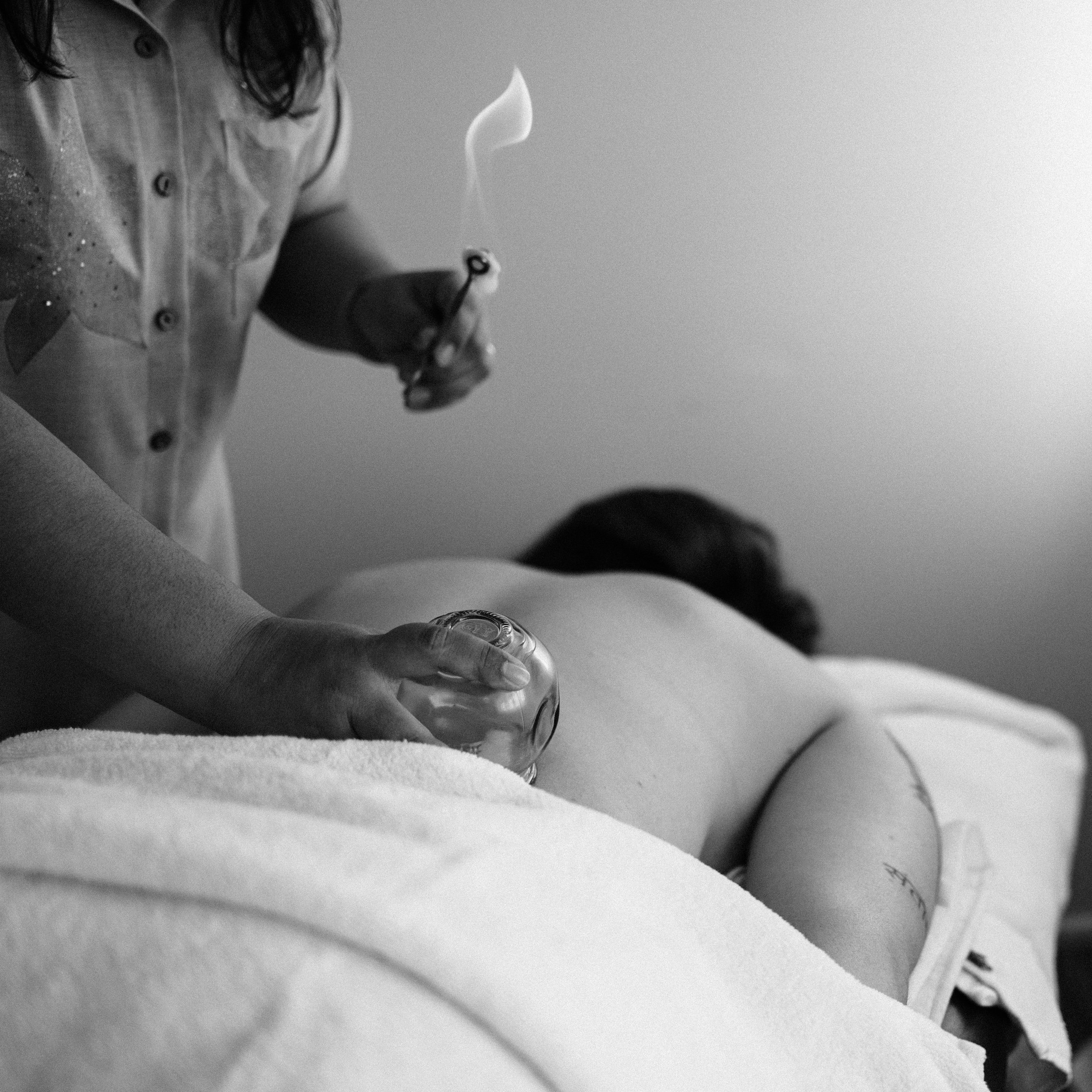 Acupuncture Cupping Therapy Jimboomba Natural Therapies