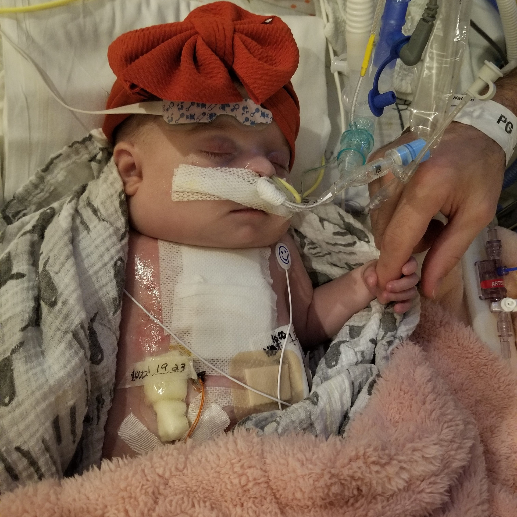 A young child in a hospital bed with a red cap, wearing an oxygen mask connected to medical tubes and devices, lying on a soft pink blanket.