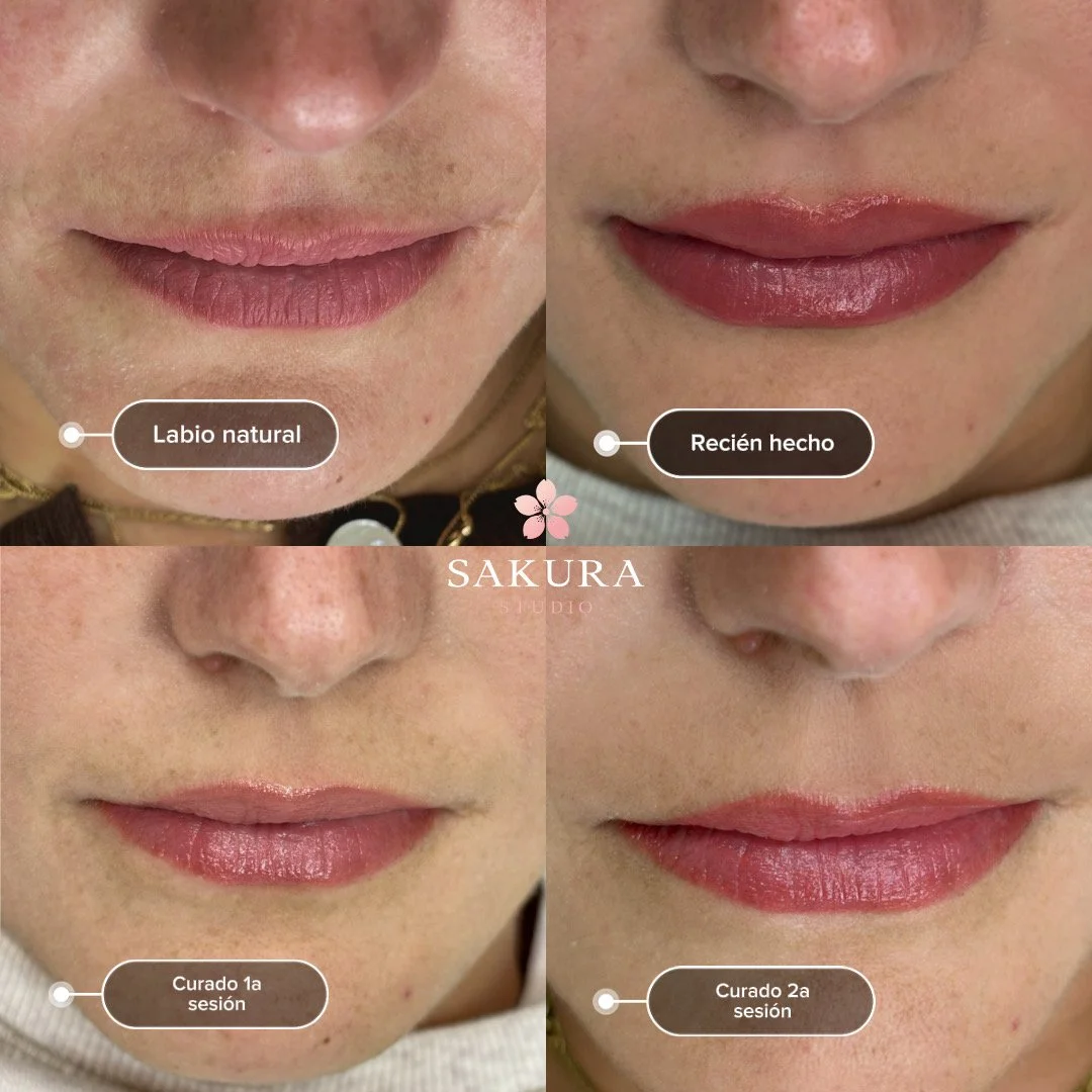 Técnica Full Lips