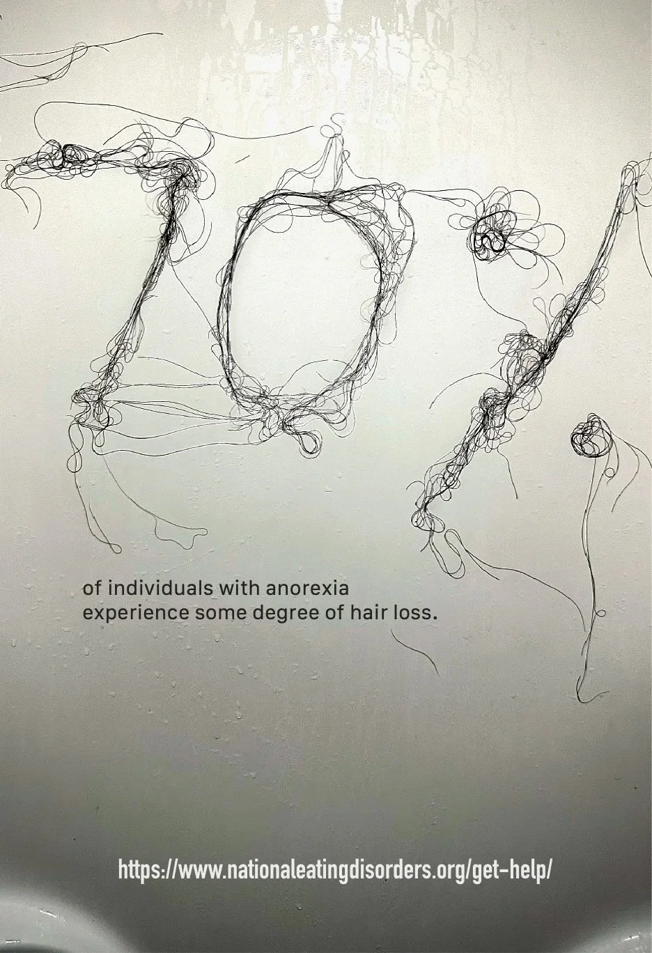 Line art drawing of hair loss with the word 'hair' and text about individuals with anorexia experiencing hair loss, along with a website link for help.