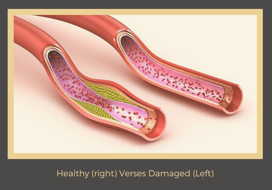 Healthy (right) Verses Damaged (Left).png