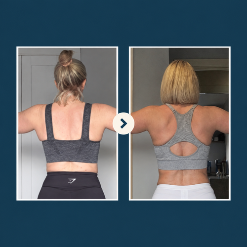 Lynn Transformation