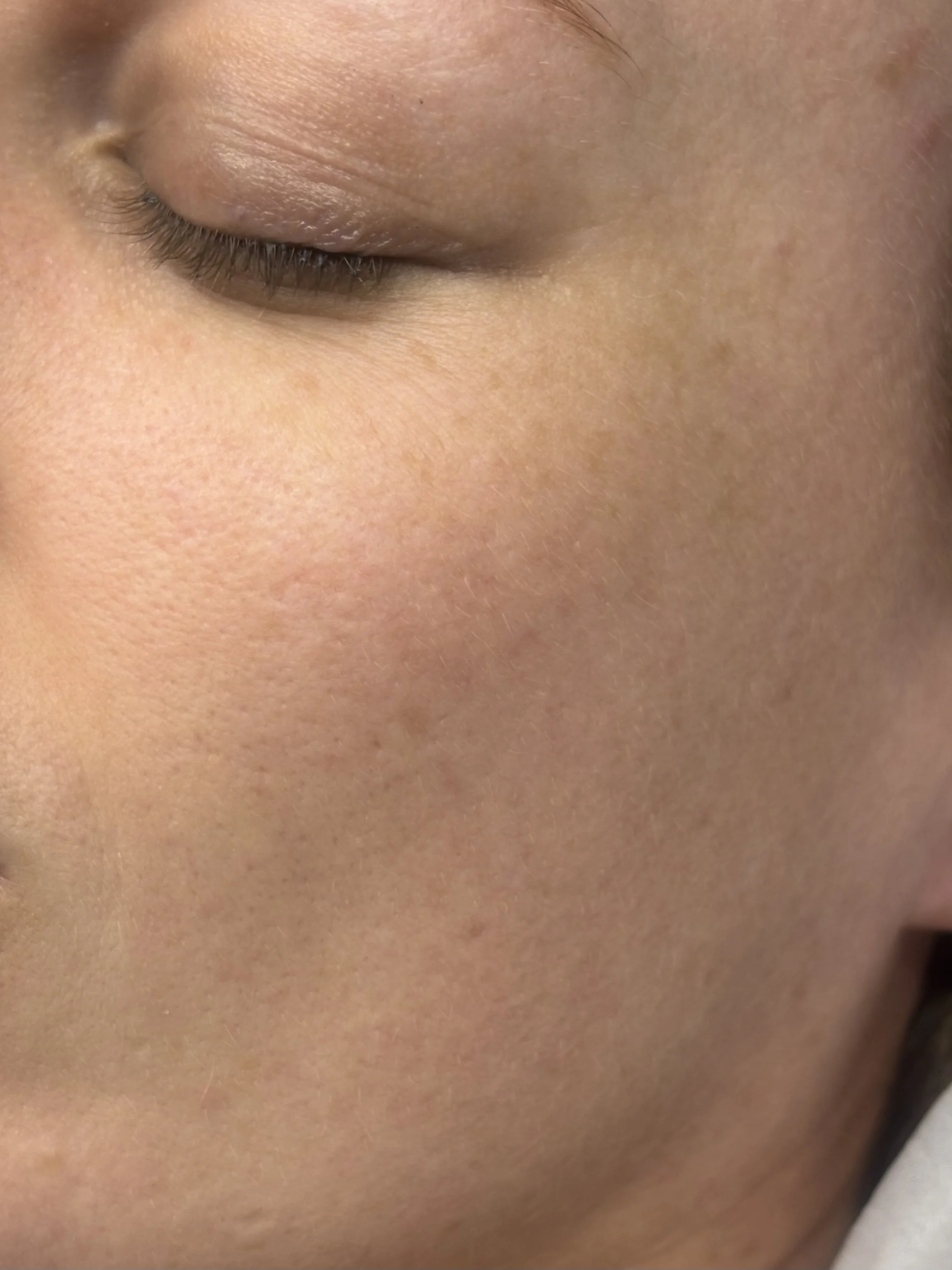 Close-up of a person's closed eye with smooth skin and natural eyelashes.