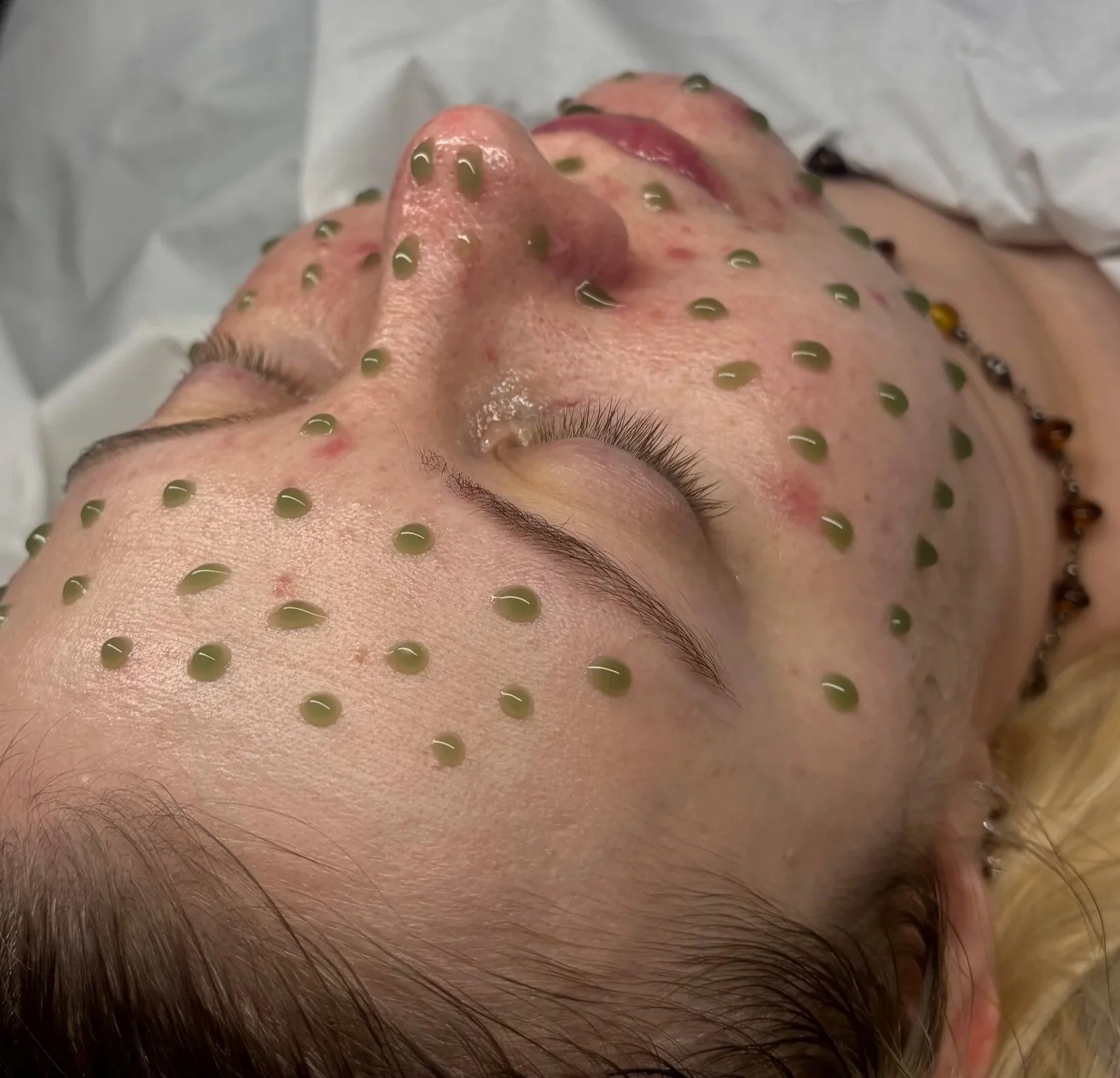 A person lying down with closed eyes, covered in small greenish-brown beads on their face, likely during a facial treatment.