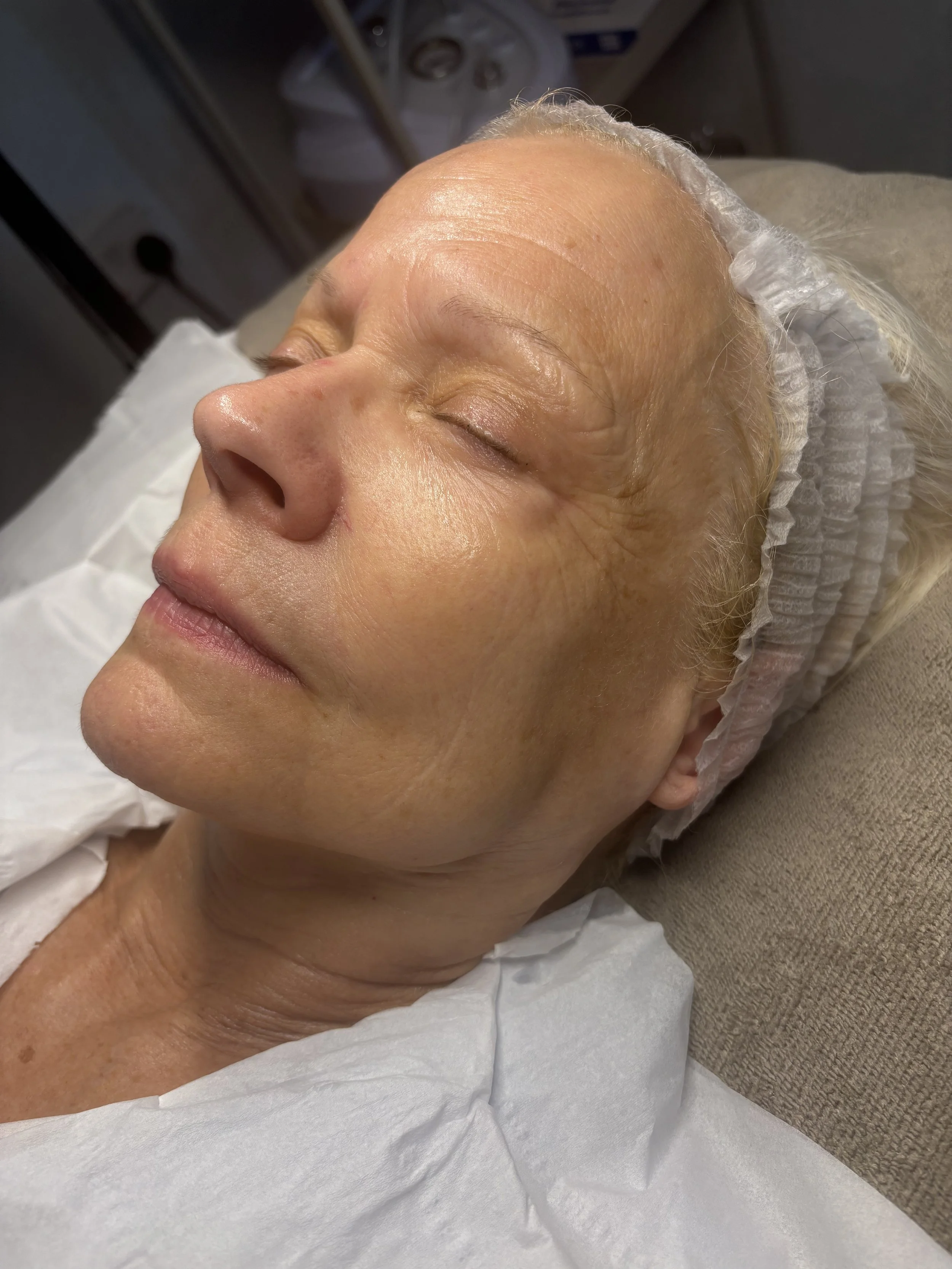 A close-up of a woman receiving a facial treatment, lying on a treatment bed with her eyes closed, wearing a hair cap, with skincare products or equipment in the background.