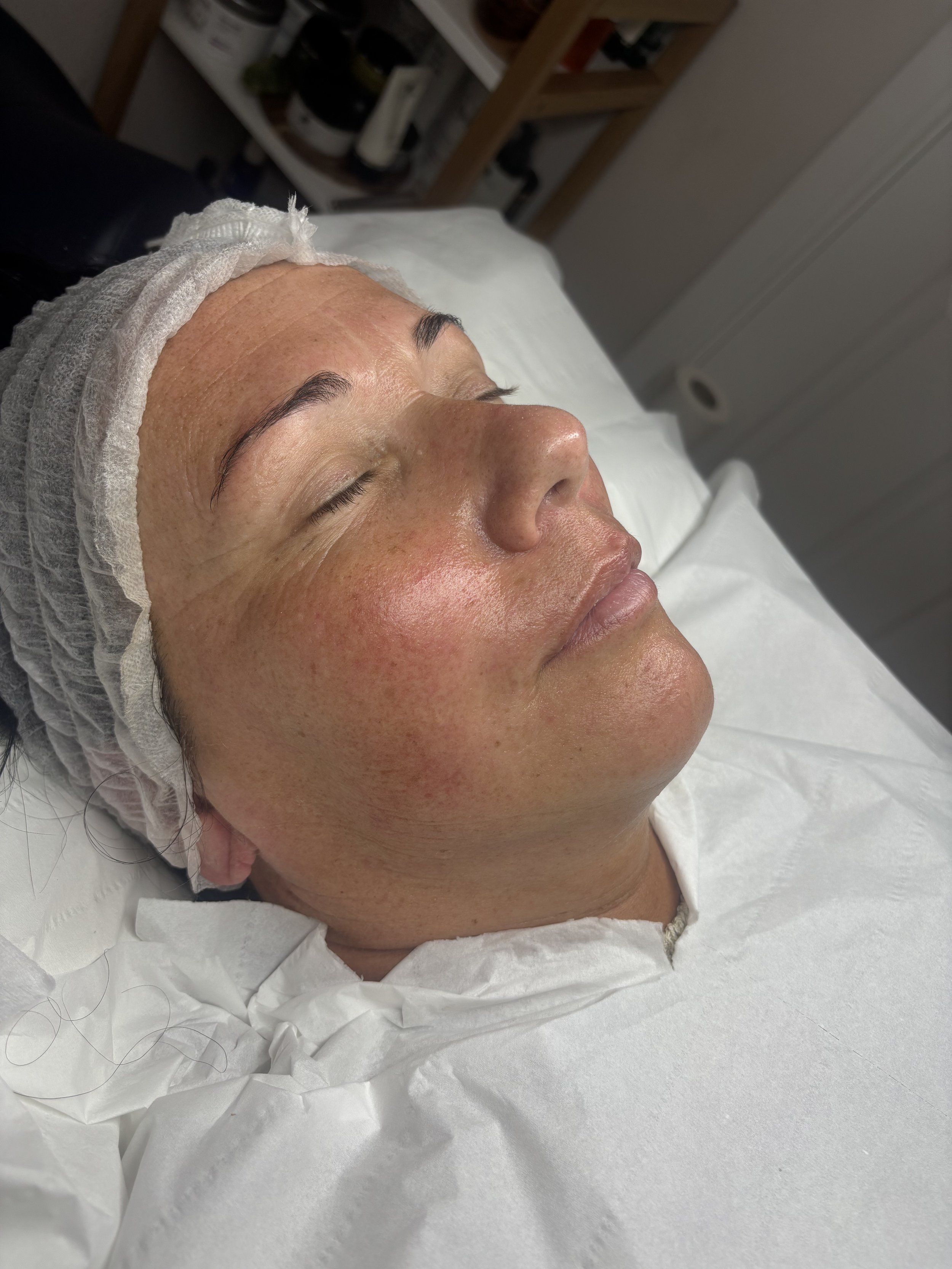 A woman with closed eyes lying on a medical bed, wearing a hair cover, in a clinical setting with medical supplies on shelves in the background.