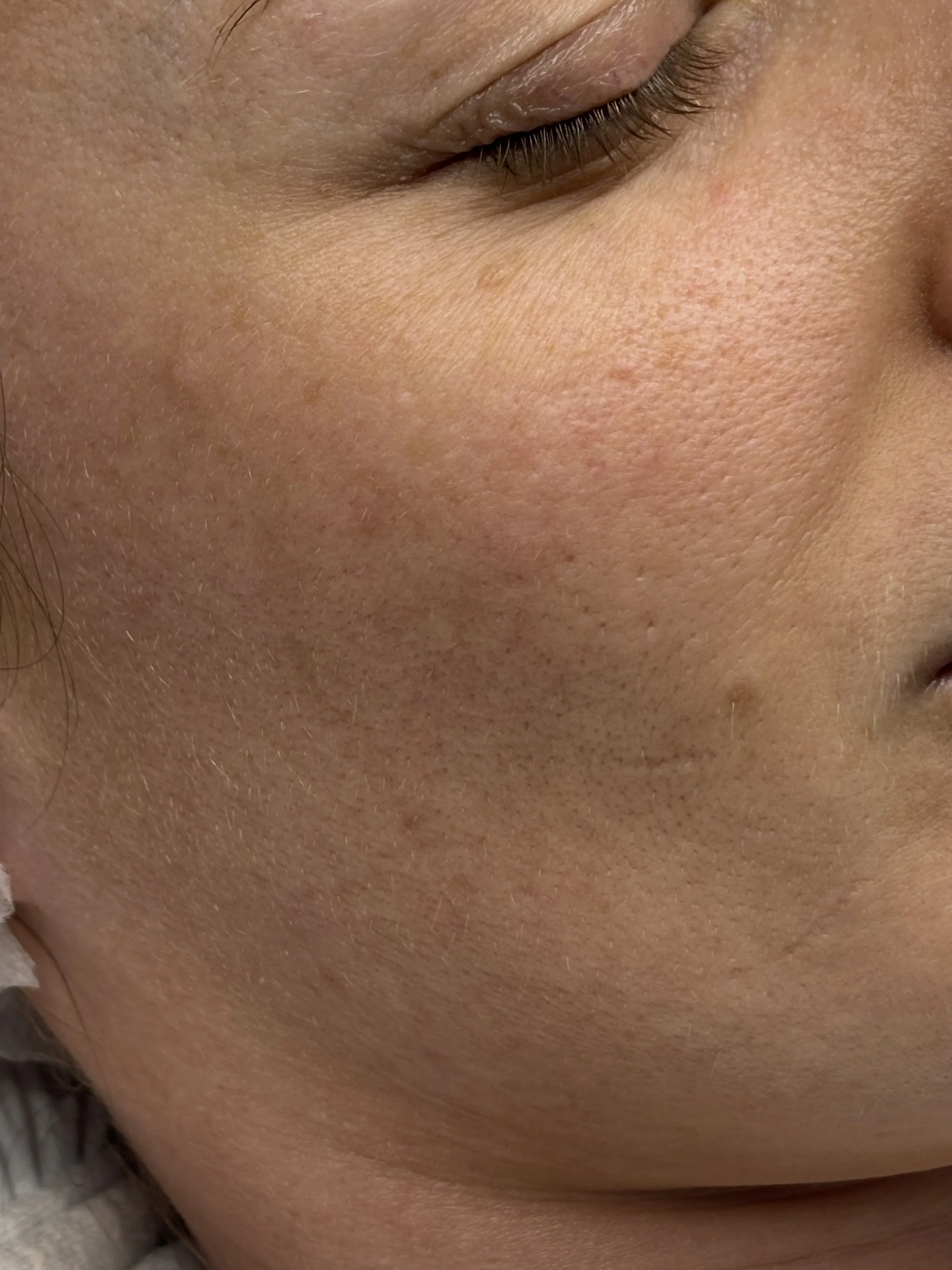 Close-up of a person's cheek and closed eye, showing skin texture, pores, and eyelashes.