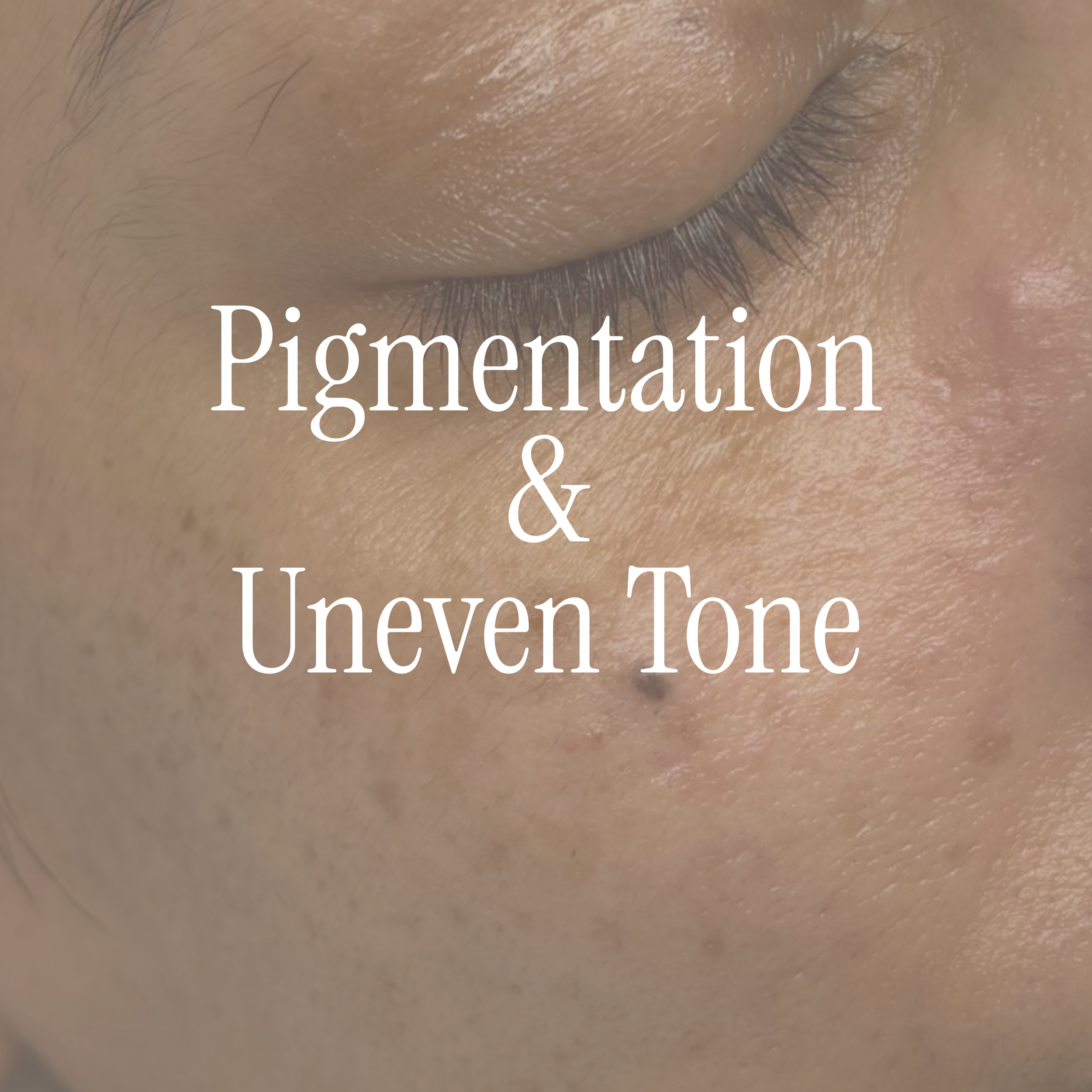 For sun damage, dark marks, melasma, post-inflammatory pigmentation and dull or uneven skin tone.