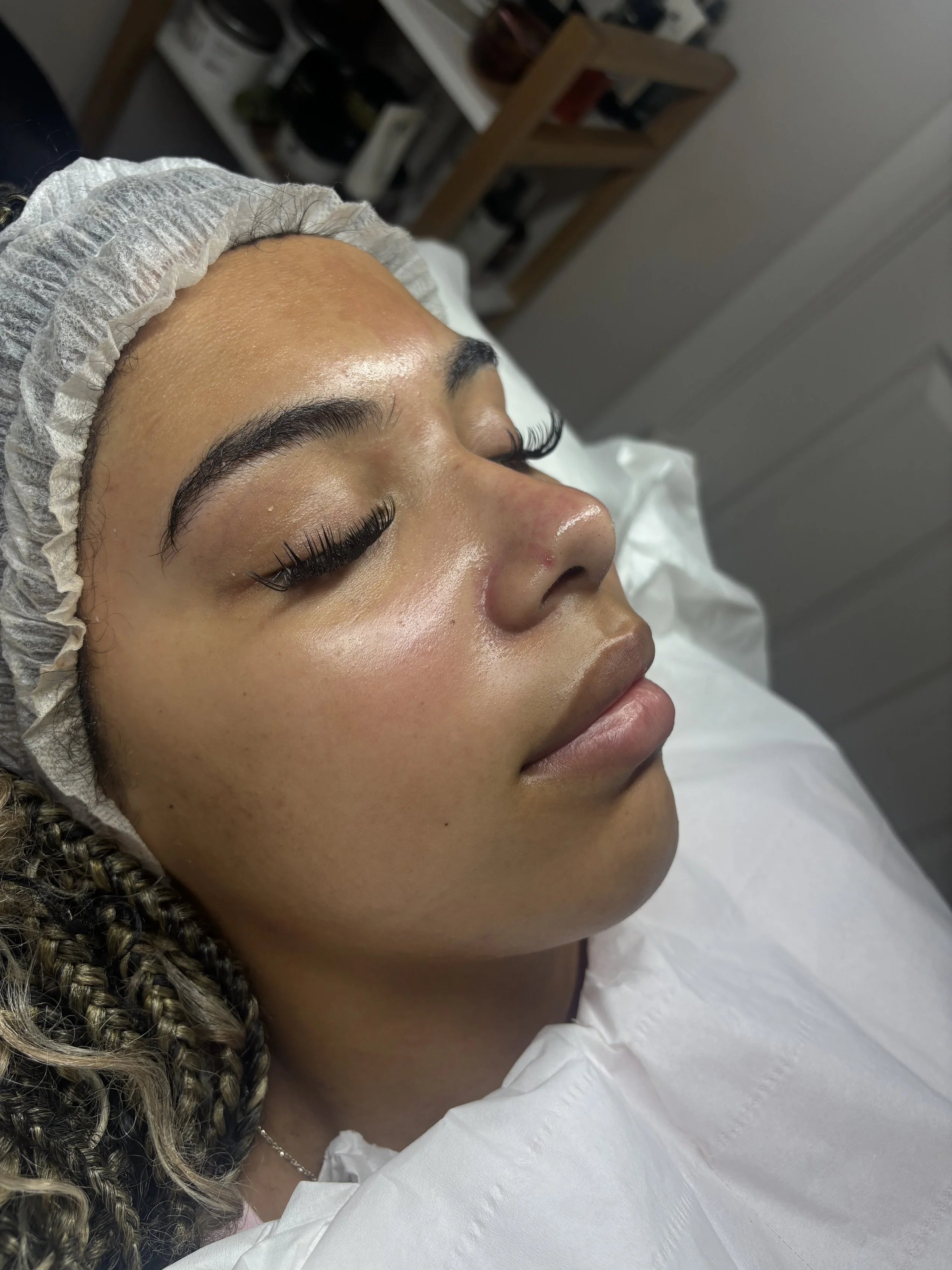 A woman with curly hair and long eyelashes lying on a medical bed with her eyes closed, wearing a disposable hair cap. The background shows shelves with various items in a clinical setting.