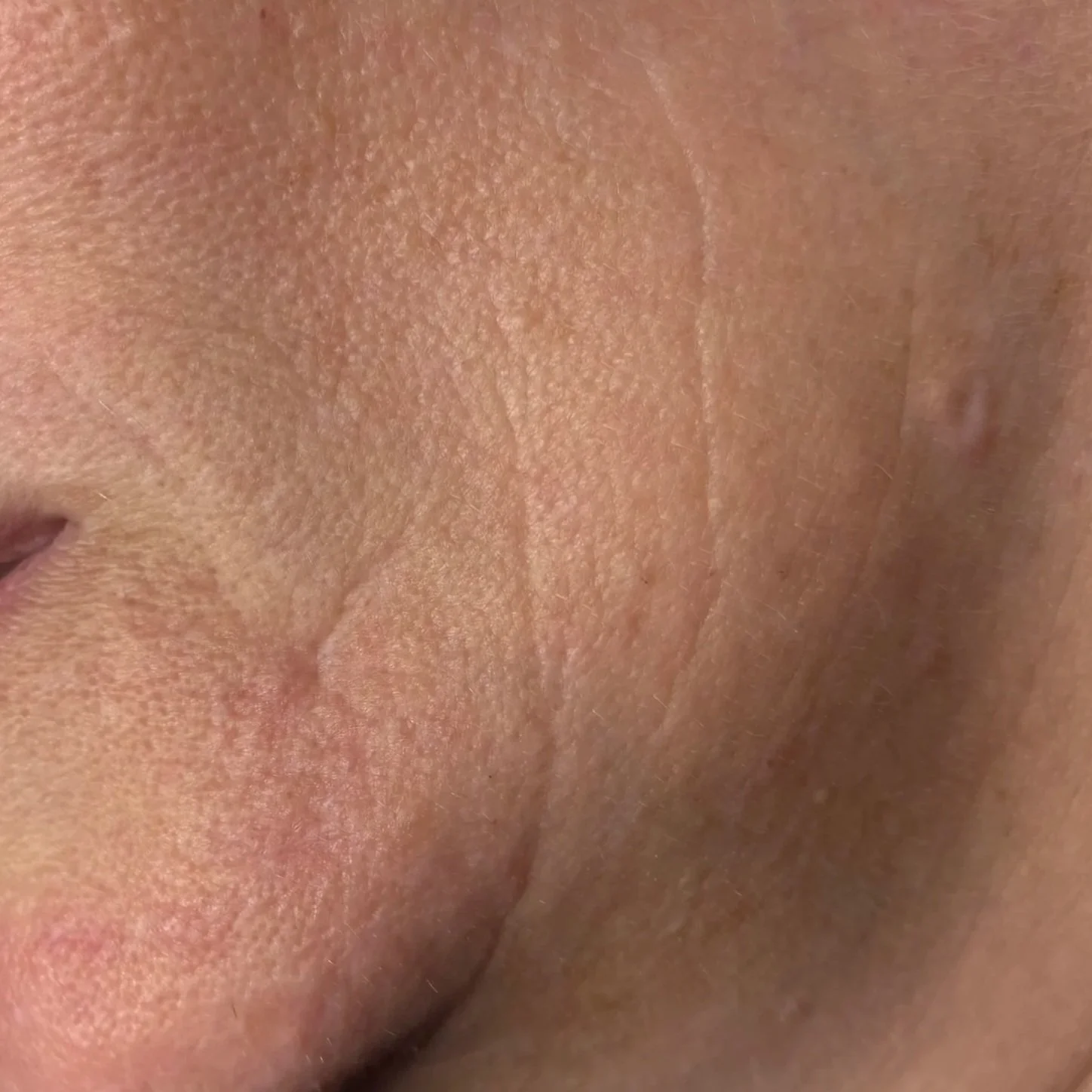 Close-up of facial skin showing texture, pores, and fine lines.