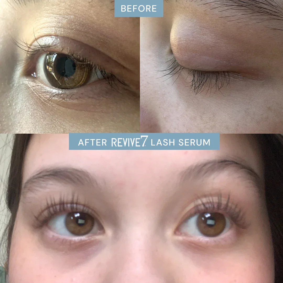 Lash-Serum-Before-After.webp