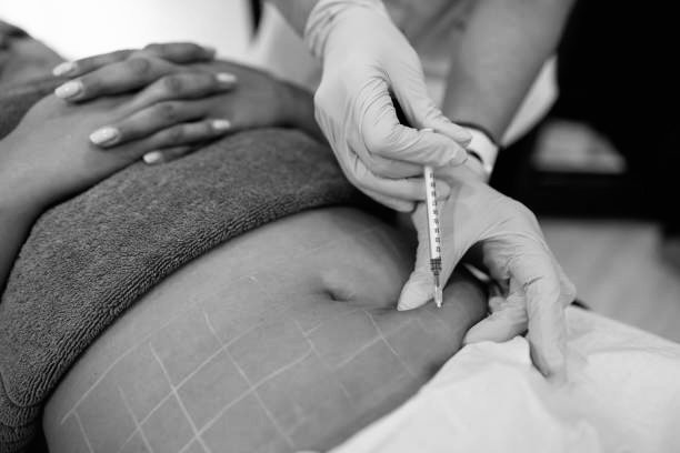 A healthcare professional is preparing to give a patient an injection in the abdomen, with hands gloved and holding a syringe.