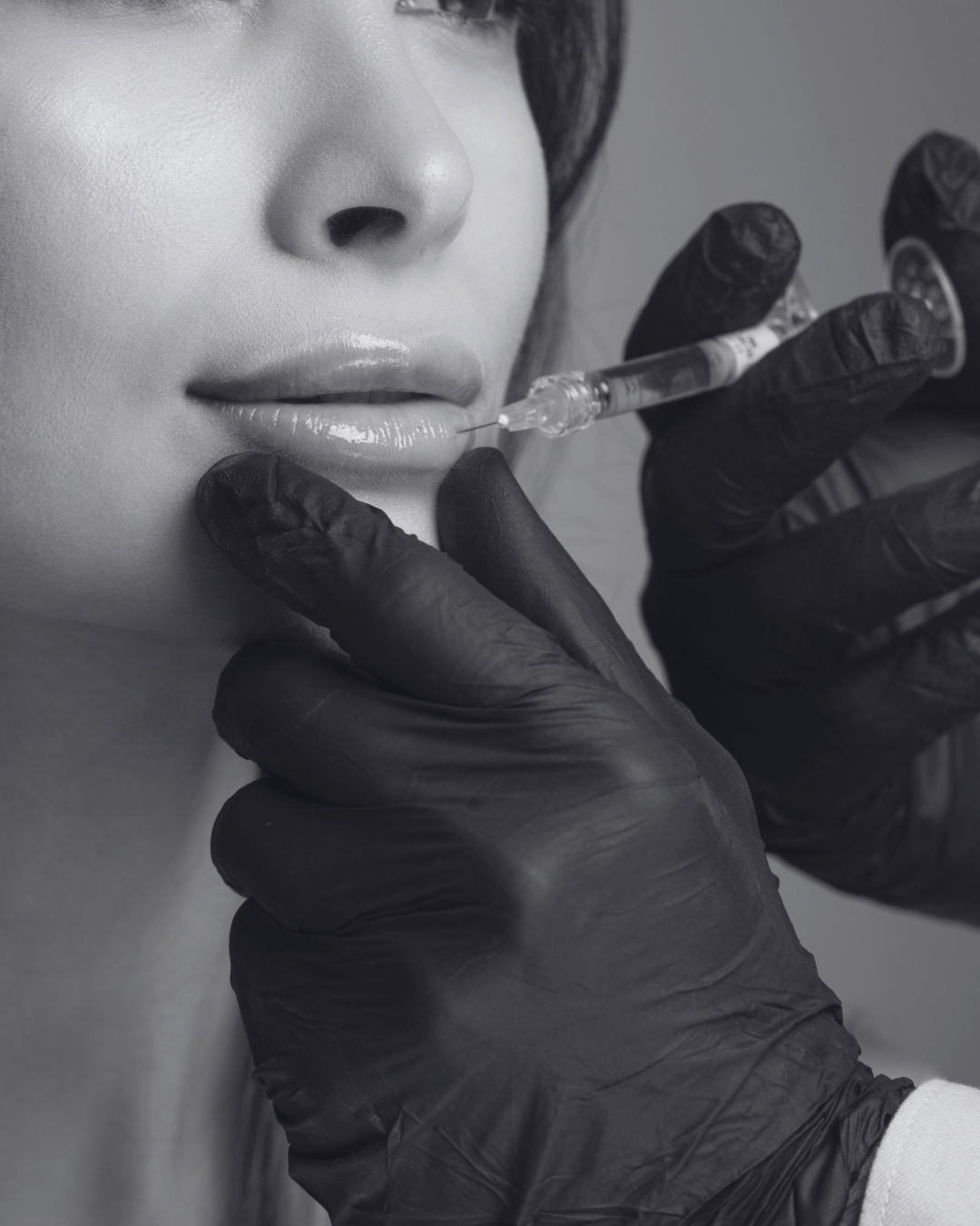 Close-up of a woman receiving a lip injection from a medical professional wearing black gloves.
