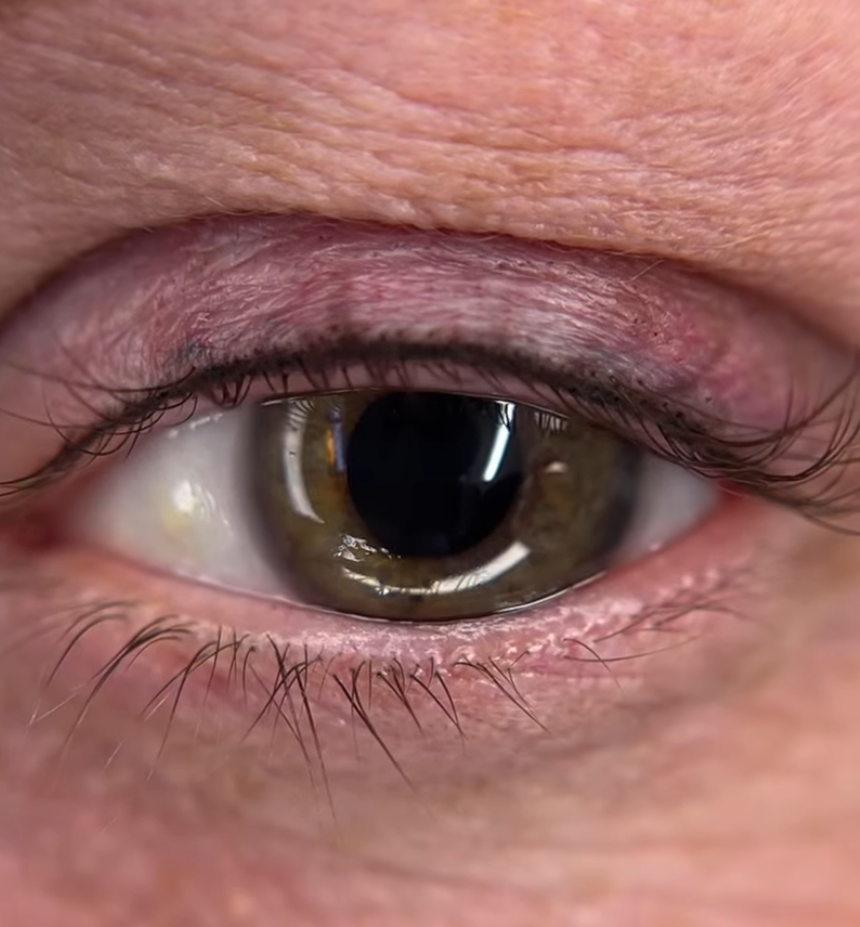 Close-up of a human eye with brown iris, surrounded by skin with visible wrinkles and eyelashes.