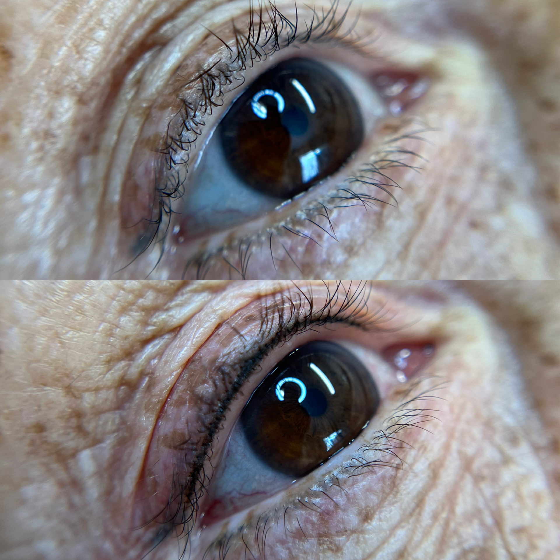 Close-up images of a human eye showing details of the iris, eyelashes, and surrounding skin.