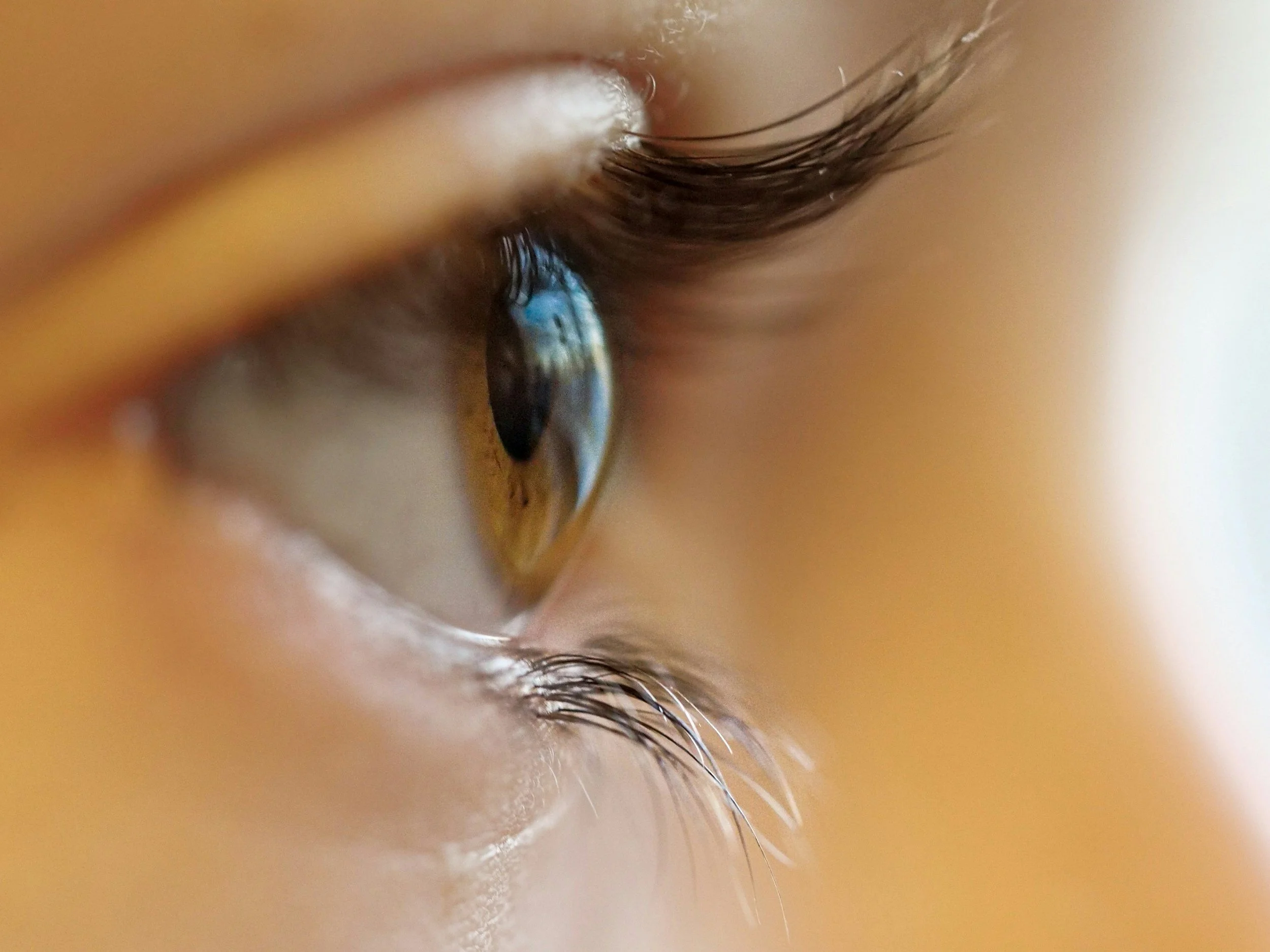 Close-up of a person's eye with droplets of white fluid on the eyelid and eyelash.