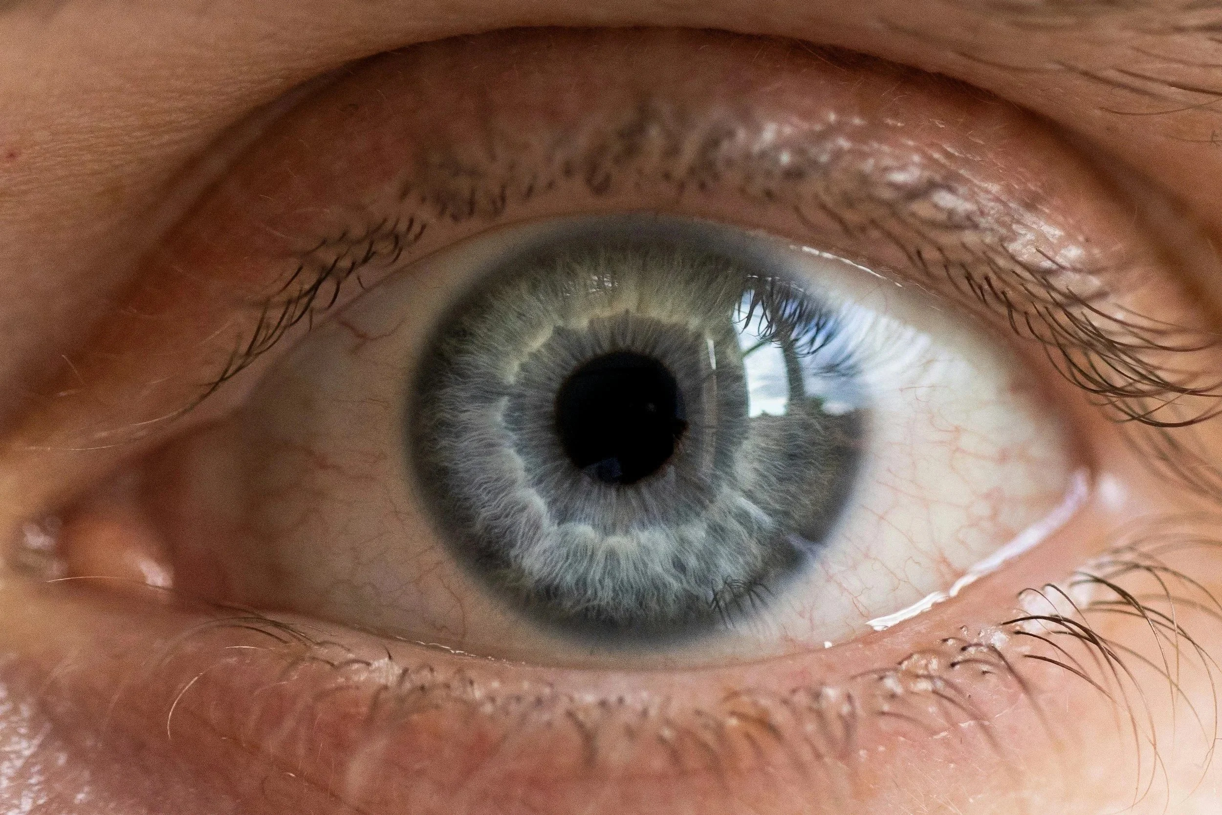 Close-up of a human eye with a grayish-blue iris and black pupil, surrounded by skin and eyelashes.
