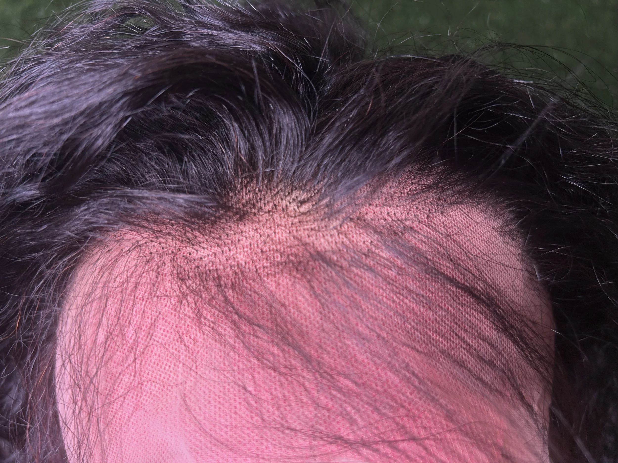 Water Wave Curly — 100% Human Hair | 13x4 Transparent Lace, 180% Density