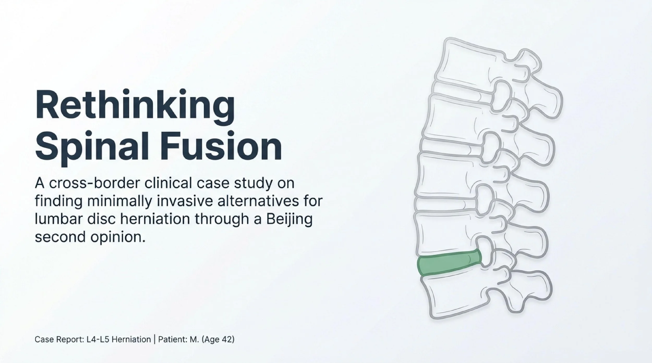 Herniated Disc Second Opinion in Beijing: An Alternative to Fusion