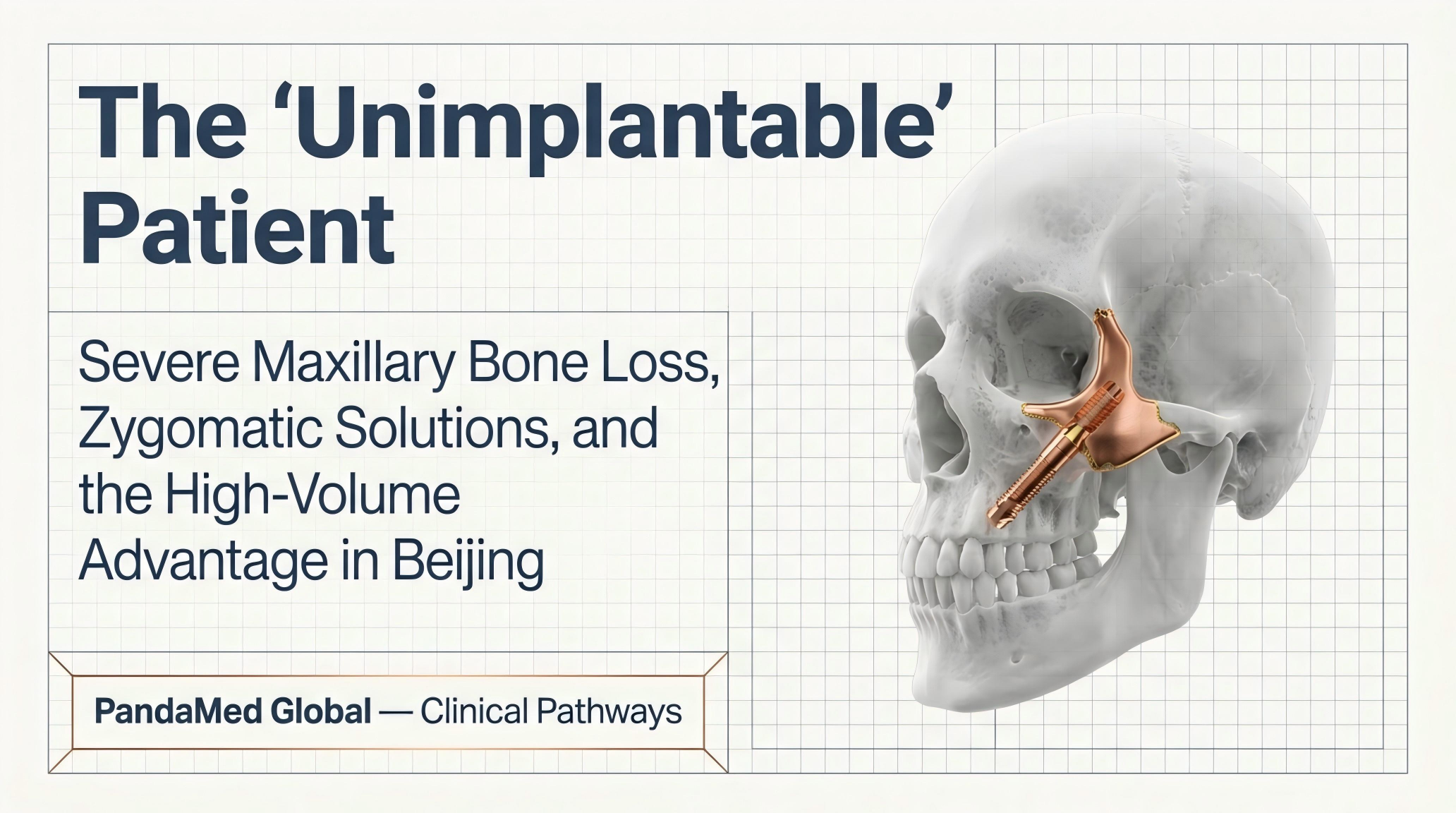 Severe Maxillary Bone Loss: Zygomatic Implant Options for "Unimplantable" Patients in Beijing