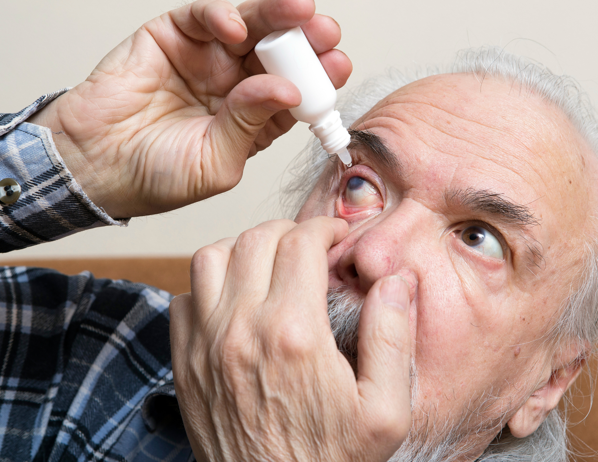 A person with gray hair and a plaid shirt is applying eye drops to his eye with his right hand, while holding his eyelid open with his left hand treating his glaucoma.
