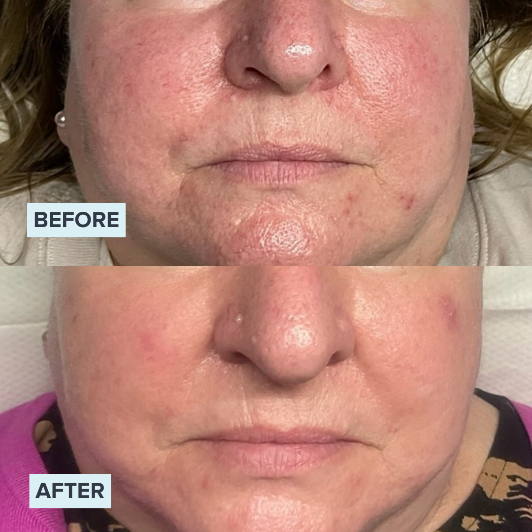 Before-& After 4.png