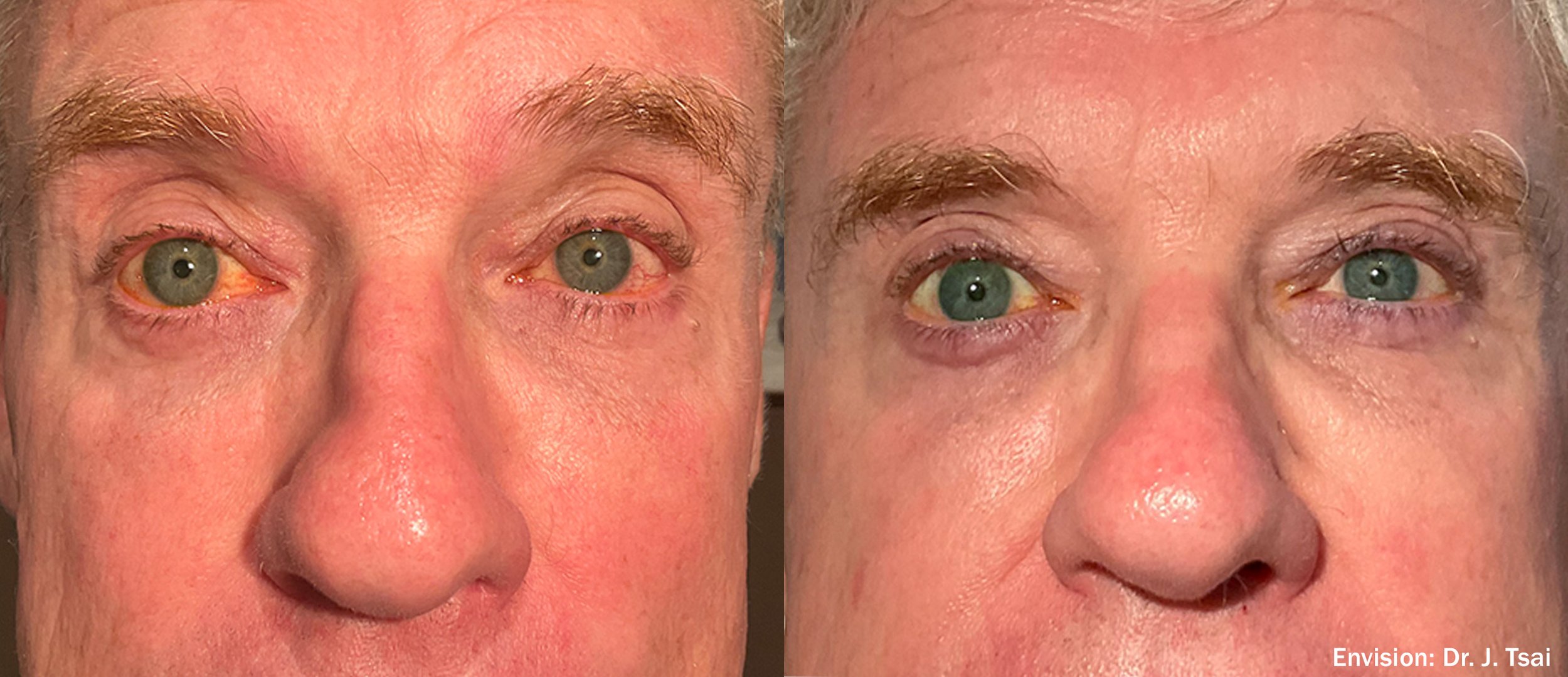 JT_Envision_Lumecca___Forma_Cheeks_14-TM.jpg