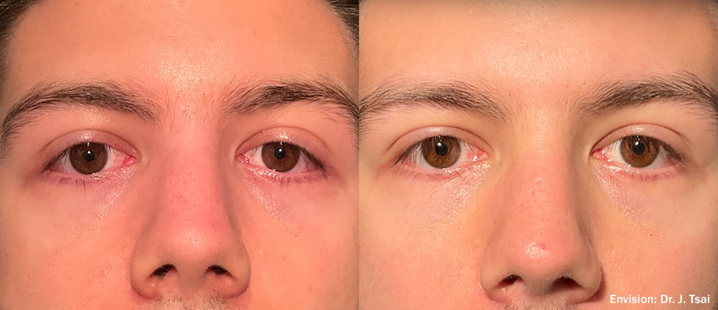 JT_Envision_Lumecca_Cheeks_1-TM.jpg