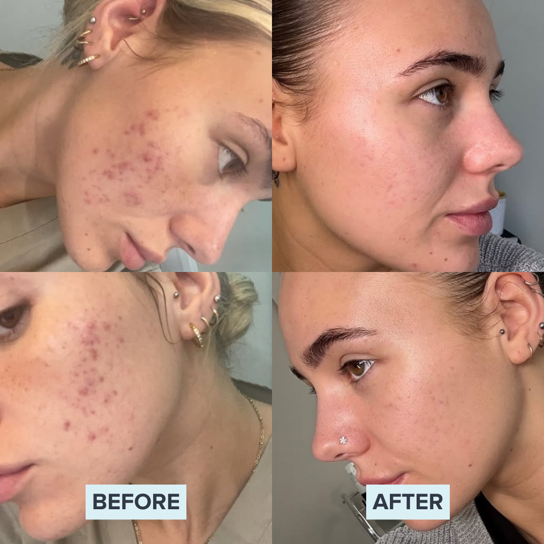 Before-& After 2.png