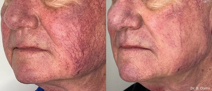 Lumecca_I_Before_and_After_1_.jpg